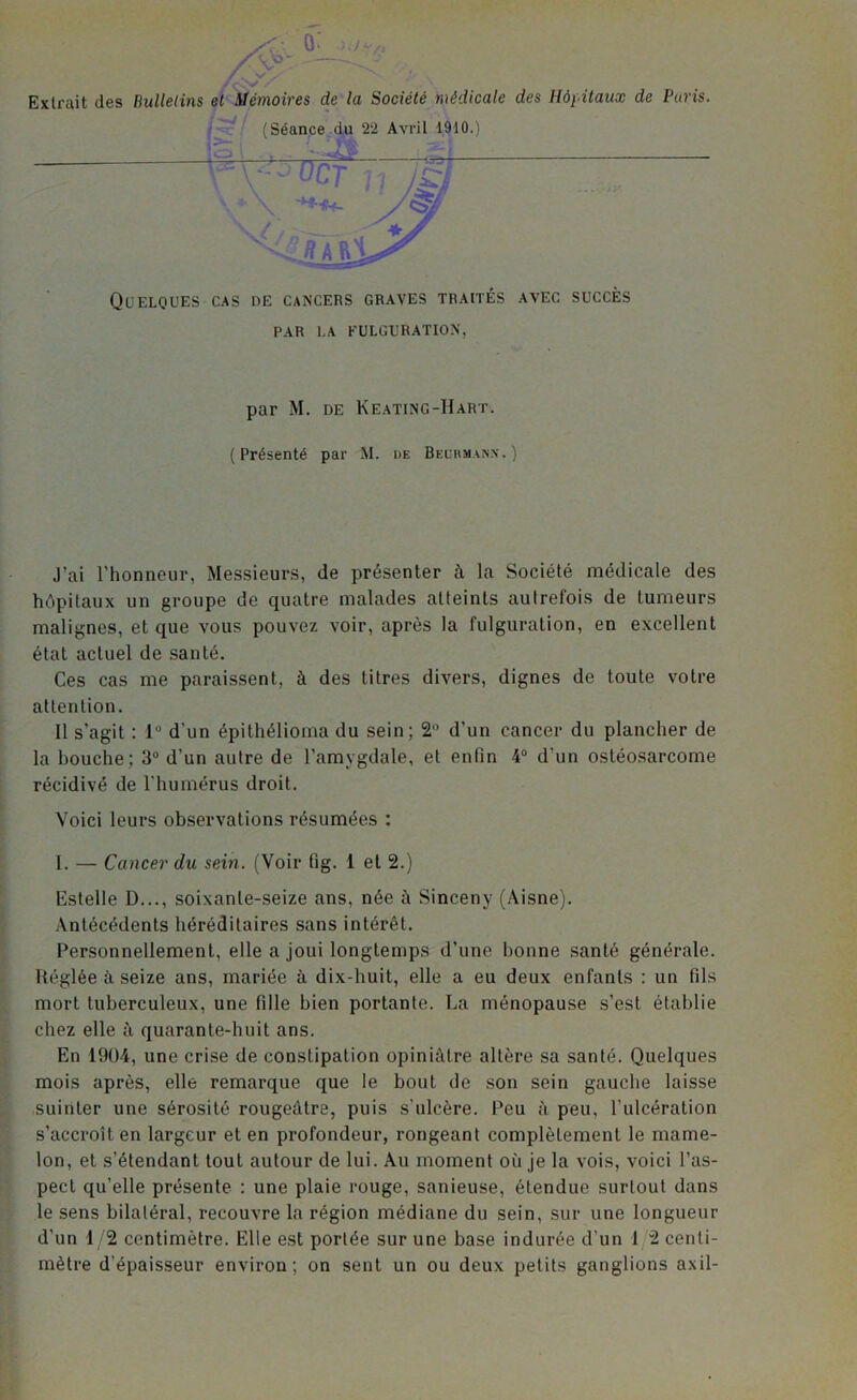 Extrait des Bulletins et Mémoires de la Société médicale des Hôpitaux de Paris. Quelques cas de cancers graves traités avec succès PAR LA FULGURATION, par M. de Keating-Hart. (Présenté par M. de Beurmann.) J’ai l'honneur, Messieurs, de présenter à la Société médicale des hôpitaux un groupe de quatre malades atteints autrefois de tumeurs malignes, et que vous pouvez voir, après la fulguration, en excellent état actuel de santé. Ces cas me paraissent, à des titres divers, dignes de toute votre attention. Il s’agit : 1° d’un épithélioma du sein; 2° d’un cancer du plancher de la bouche; 3° d’un autre de l’amygdale, et enfin 4° d’un ostéosarcome récidivé de l'humérus droit. Voici leurs observations résumées : 1. — Cancer du sein. (Voir tîg. 1 et 2.) Estelle D..., soixante-seize ans, née à Sinceny (Aisne). Antécédents héréditaires sans intérêt. Personnellement, elle a joui longtemps d’une bonne santé générale. Uéglée à seize ans, mariée à dix-huit, elle a eu deux enfants : un fils mort tuberculeux, une fille bien portante. La ménopause s’est établie chez elle à quarante-huit ans. En 1904, une crise de constipation opiniâtre altère sa santé. Quelques mois après, elle remarque que le bout de son sein gauche laisse suinter une sérosité rougeâtre, puis s’ulcère. Peu à peu, l’ulcération s’accroît en largeur et en profondeur, rongeant complètement le mame- lon, et s’étendant tout autour de lui. Au moment où je la vois, voici l’as- pect qu’elle présente : une plaie rouge, sanieuse, étendue surtout dans le sens bilatéral, recouvre la région médiane du sein, sur une longueur d’un 1/2 centimètre. Elle est portée sur une base indurée d'un 1 2 centi- mètre d’épaisseur environ; on sent un ou deux petits ganglions axil-