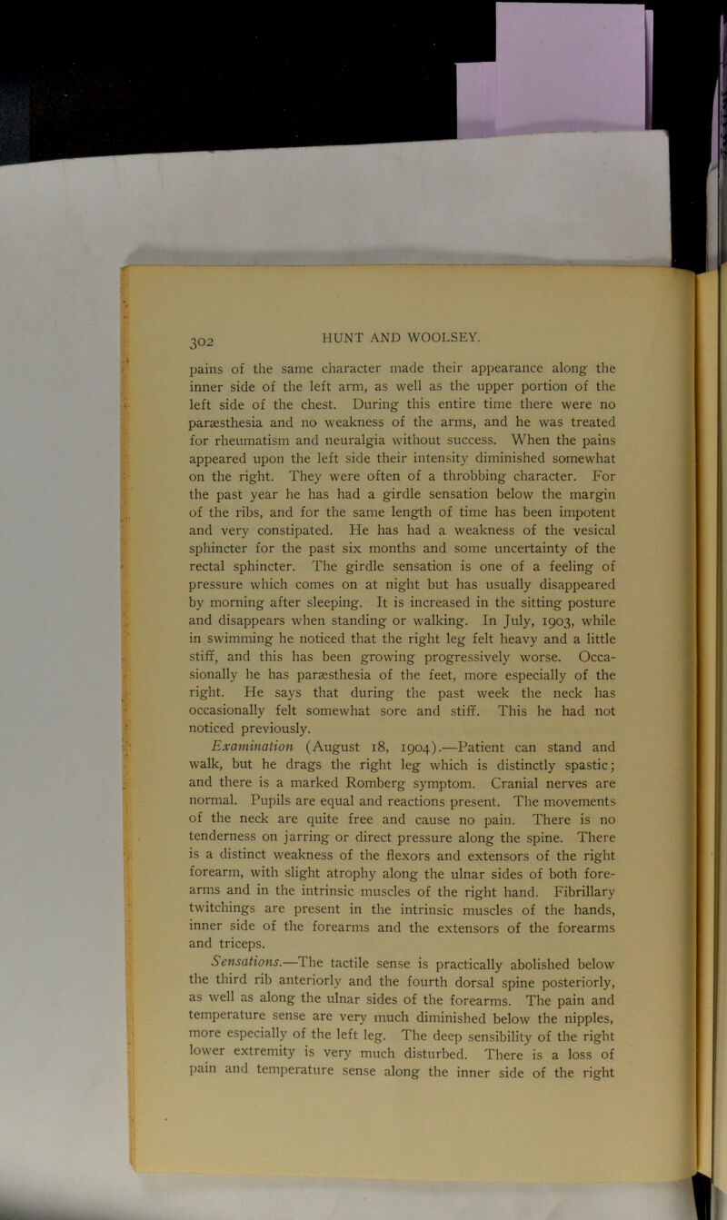 pains of the same character made their appearance along the inner side of the left arm, as well as the upper portion of the left side of the chest. During this entire time there were no parassthesia and no weakness of the arms, and he was treated for rheumatism and neuralgia without success. When the pains appeared upon the left side their intensity diminished somewhat on the right. They were often of a throbbing character. For the past year he has had a girdle sensation below the margin of the ribs, and for the same length of time has been impotent and very constipated. He has had a weakness of the vesical sphincter for the past six months and some uncertainty of the rectal sphincter. The girdle sensation is one of a feeling of pressure which comes on at night but has usually disappeared by morning after sleeping. It is increased in the sitting posture and disappears when standing or walking. In July, 1903, while in swimming he noticed that the right leg felt heavy and a little stiff, and this has been growing progressively worse. Occa- sionally he has parsesthesia of the feet, more especially of the right. He says that during the past week the neck has occasionally felt somewhat sore and stiff. This he had not noticed previously. Examination (August 18, 1904).—Patient can stand and walk, but he drags the right leg which is distinctly spastic; and there is a marked Romberg symptom. Cranial nerves are normal. Pupils are equal and reactions present. The movements of the neck are quite free and cause no pain. There is no tenderness on jarring or direct pressure along the spine. There is a distinct weakness of the flexors and extensors of the right forearm, with slight atrophy along the ulnar sides of both fore- arms and in the intrinsic muscles of the right hand. Fibrillary twitchings are present in the intrinsic muscles of the hands, inner side of the forearms and the extensors of the forearms and triceps. Sensations.—The tactile sense is practically abolished below the third rib anteriorly and the fourth dorsal spine posteriorly, as well as along the ulnar sides of the forearms. The pain and temperature sense are very much diminished below the nipples, more especially of the left leg. The deep sensibility of the right lower extremity is very much disturbed. There is a loss of pain and temperature sense along the inner side of the right