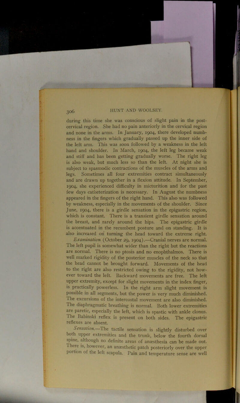 during this time she was conscious of slight pain in the post- cervical region. She had no pain anteriorly in the cervical region and none in the arms. In January, 1904, there developed numb- ness in the fingers which gradually passed up the inner side of the left arm. This was soon followed by a weakness in the left hand and shoulder. In March, 1904, the left leg became weak and stiff and has been getting gradually worse. The right leg is also weak, but much less so than the left. At night she is subject to spasmodic contractions of the muscles of the arms and legs. Sometimes all four extremities contract simultaneously and are drawn up together in a flexion attitude. In September, 1904, she experienced difficulty in micturition and for the past few days catheterization is necessary. In August the numbness appeared in the fingers of the right hand. This also was followed by weakness, especially in the movements of the shoulder. Since June, 1904, there is a girdle sensation in the epigastric region, which is constant. There is a transient girdle sensation around the breast, and rarely around the hips. The epigastric girdle is accentuated in the recumbent posture and on standing. It is also increased on turning the head toward the extreme right. Examination (October 29, 1904).—Cranial nerves are normal. The left pupil is somewhat wider than the right but the reactions are normal. There is no ptosis and no enophthalmos. There is well marked rigidity of the posterior muscles of the neck so that the head cannot be brought forward. Movements of the head to the right are also restricted owing to the rigidity, not how- ever toward the left. Backward movements are free. The left upper extremity, except for slight movements in the index finger, is practically powerless. In the right arm slight movement is possible in all segments, but the power is very much diminished. I he excursions of the intercostal movement are also diminished. The diaphragmatic breathing is normal. Both lower extremities are paretic, especially the left, which is spastic with ankle clonus. The Babinski reflex is present on both sides. The epigastric reflexes are absent. Sensation. The tactile sensation is slightly disturbed over both upper extremities and the trunk, below the fourth dorsal spine, although no definite areas of anaesthesia can be made out. There is, however, an anaesthetic patch posteriorly over the upper portion of the left scapula. Pain and temperature sense are well