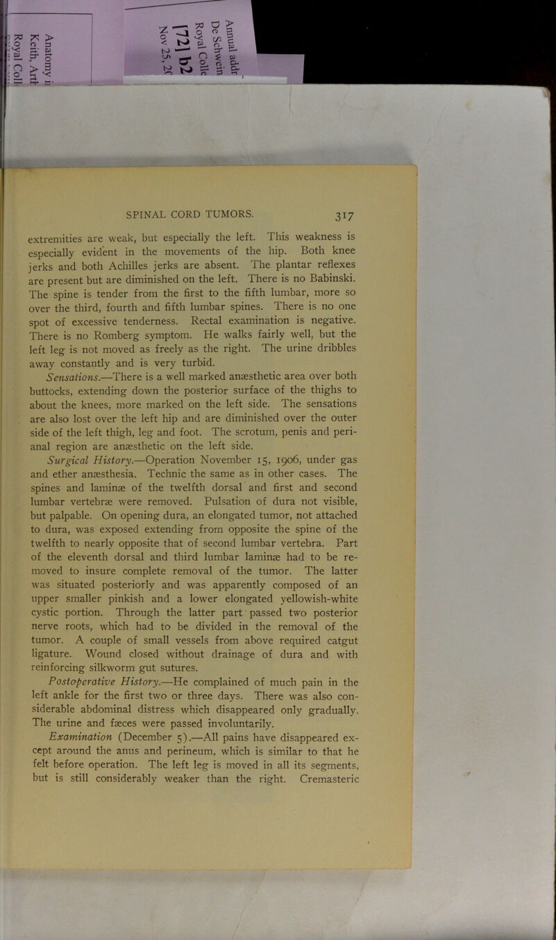 extremities are weak, but especially the left. This weakness is especially evident in the movements of the hip. Both knee jerks and both Achilles jerks are absent. The plantar reflexes are present but are diminished on the left. There is no Babinski. The spine is tender from the first to the fifth lumbar, more so over the third, fourth and fifth lumbar spines. There is no one spot of excessive tenderness. Rectal examination is negative. There is no Romberg symptom. He walks fairly well, but the left leg is not moved as freely as the right. The urine dribbles away constantly and is very turbid. Sensations.—There is a well marked anaesthetic area over both buttocks, extending down the posterior surface of the thighs to about the knees, more marked on the left side. The sensations are also lost over the left hip and are diminished over the outer side of the left thigh, leg and foot. The scrotum, penis and peri- anal region are anaesthetic on the left side. Surgical History.—Operation November 15, 1906, under gas and ether anaesthesia. Technic the same as in other cases. The spines and laminae of the twelfth dorsal and first and second lumbar vertebrae were removed. Pulsation of dura not visible, but palpable. On opening dura, an elongated tumor, not attached to dura, was exposed extending from opposite the spine of the twelfth to nearly opposite that of second lumbar vertebra. Part of the eleventh dorsal and third lumbar laminae had to be re- moved to insure complete removal of the tumor. The latter was situated posteriorly and was apparently composed of an upper smaller pinkish and a lower elongated yellowish-white cystic portion. Through the latter part passed two posterior nerve roots, which had to be divided in the removal of the tumor. A couple of small vessels from above required catgut ligature. Wound closed without drainage of dura and with reinforcing silkworm gut sutures. Postoperative History.—He complained of much pain in the left ankle for the first two or three days. There was also con- siderable abdominal distress which disappeared only gradually. The urine and faeces were passed involuntarily. Examination (December 5).—All pains have disappeared ex- cept around the anus and perineum, which is similar to that he felt before operation. The left leg is moved in all its segments, but is still considerably weaker than the right. Cremasteric