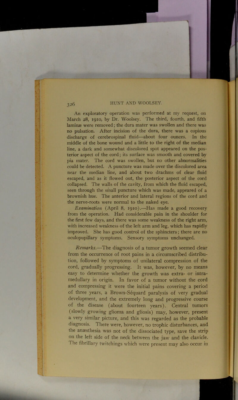 An exploratory operation was performed at my request, on March 28, 1910, by Dr. Woolsey. The third, fourth, and fifth laminae were removed; the dura mater was swollen and there was no pulsation. After incision of the dura, there was a copious discharge of cerebrospinal fluid—about four ounces. In the middle of the bone wound and a little to the right of the median line, a dark and somewhat discolored spot appeared on the pos- terior aspect of the cord; its surface was smooth and covered by pia mater. The cord was swollen, but no other abnormalities could be detected. A puncture was made over the discolored area near the median line, and about two drachms of clear fluid escaped, and as it flowed out, the posterior aspect of the cord collapsed. The walls of the cavity, from which the fluid escaped, seen through the small puncture which was made, appeared of a brownish hue. The anterior and lateral regions of the cord and the nerve-roots were normal to the naked eye. Examination (April 8, 1910).—Has made a good recovery from the operation. Had considerable pain in the shoulder for the first few days, and there was some weakness of the right arm, with increased weakness of the left arm and leg, which has rapidly improved. She has good control of the sphincters; there are no oculopupillary symptoms. Sensory symptoms unchanged. Remarks.—The diagnosis of a tumor growth seemed clear from the occurrence of root pains in a circumscribed distribu- tion, followed by symptoms of unilateral compression of the cord, gradually progressing. It was, however, by no means easy to determine whether the growth was extra- or intra- medullary in origin. In favor of a tumor without the cord and compressing it were the initial pains covering a period of three years, a Brown-Sequard paralysis of very gradual development, and the extremely long and progressive course of the disease (about fourteen years). Central tumors (slowly growing glioma and gliosis) may, however, present a very similar picture, and this was regarded as the probable diagnosis. There were, however, no trophic disturbances, and the anaesthesia was not of the dissociated type, save the strip on the left side of the neck between the jaw and the clavicle. The fibrillary twitchings which were present may also occur in