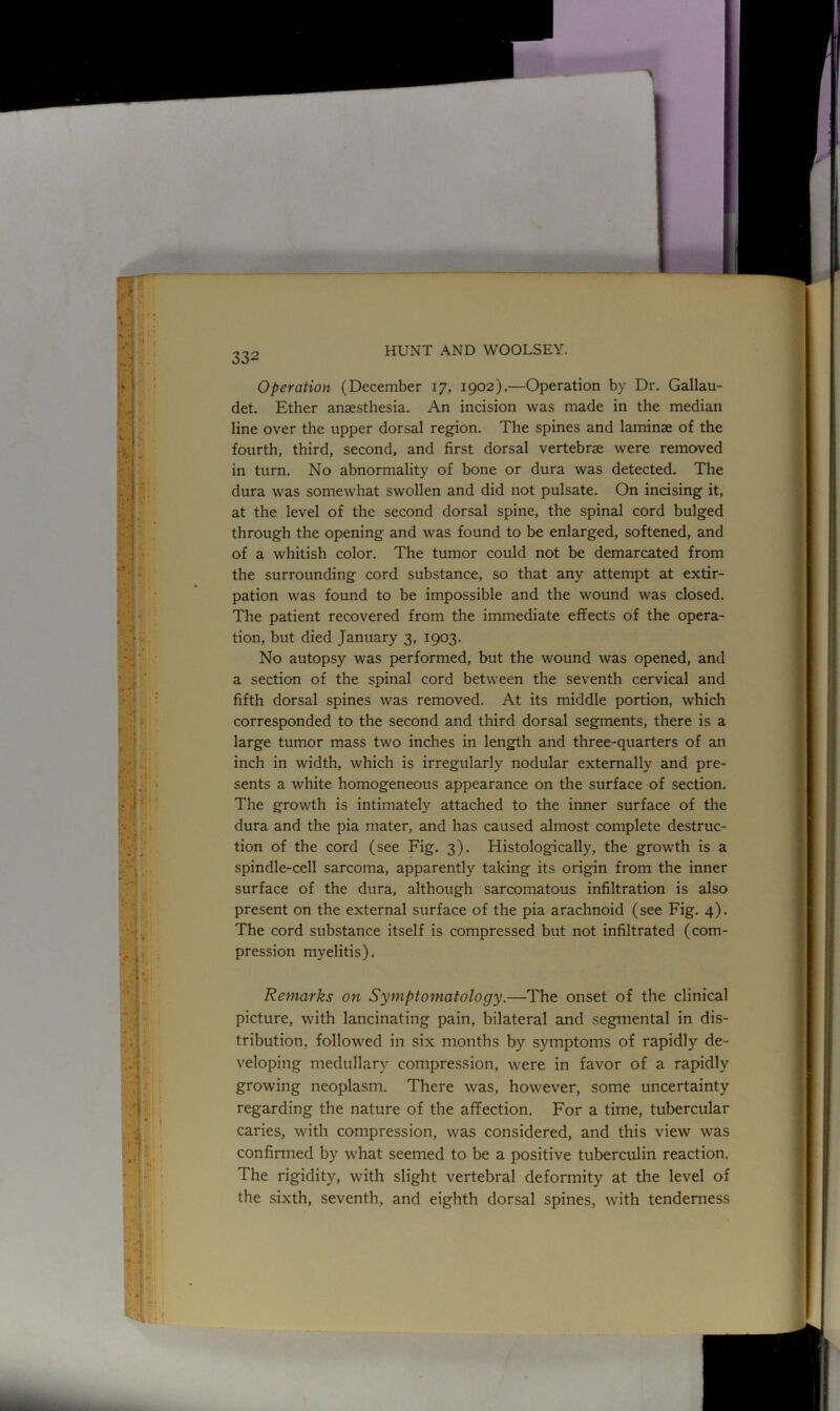 Operation (December 17, 1902).—Operation by Dr. Gallau- det. Ether anaesthesia. An incision was made in the median line over the upper dorsal region. The spines and laminae of the fourth, third, second, and first dorsal vertebrae were removed in turn. No abnormality of bone or dura was detected. The dura was somewhat swollen and did not pulsate. On incising it, at the level of the second dorsal spine, the spinal cord bulged through the opening and was found to be enlarged, softened, and of a whitish color. The tumor could not be demarcated from the surrounding cord substance, so that any attempt at extir- pation was found to be impossible and the wound was closed. The patient recovered from the immediate effects of the opera- tion, but died January 3, 1903. No autopsy was performed, but the wound was opened, and a section of the spinal cord between the seventh cervical and fifth dorsal spines was removed. At its middle portion, which corresponded to the second and third dorsal segments, there is a large tumor mass two inches in length and three-quarters of an inch in width, which is irregularly nodular externally and pre- sents a white homogeneous appearance on the surface of section. The growth is intimately attached to the inner surface of the dura and the pia mater, and has caused almost complete destruc- tion of the cord (see Fig. 3). Histologically, the growth is a spindle-cell sarcoma, apparently taking its origin from the inner surface of the dura, although sarcomatous infiltration is also present on the external surface of the pia arachnoid (see Fig. 4). The cord substance itself is compressed but not infiltrated (com- pression myelitis). Remarks on Symptomatology.—The onset of the clinical picture, with lancinating pain, bilateral and segmental in dis- tribution, followed in six months by symptoms of rapidly de- veloping medullary compression, were in favor of a rapidly growing neoplasm. There was, however, some uncertainty regarding the nature of the affection. For a time, tubercular caries, with compression, was considered, and this view was confirmed by what seemed to be a positive tuberculin reaction. The rigidity, with slight vertebral deformity at the level of the sixth, seventh, and eighth dorsal spines, with tenderness