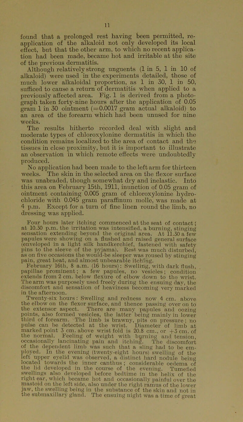 found that a prolonged rest having been permitted, re- application of the alkaloid not only developed its local effect, but that the other arm, to which no recent applica- tion had been made, became hot and irritable at the site of the previous dermatitis. Although relatively strong unguents (1 in 5, 1 in 10 of alkaloid) were used in the experiments detailed, those of much lower alkaloidal proportion, as 1 in 30, 1 in 50, sufficed to cause a return of dermatitis when applied to a previously affected area. Fig. 1 is derived from a photo- graph taken forty-nine hours after the application of 0.05 gram 1 in 30 ointment (=0.0017 gram actual alkaloid) to an area of the forearm which had been unused for nine weeks. The results hitherto recorded deal with slight and moderate types of cliloroxylonine dermatitis in which the condition remains localized to the area of contact and the tissues in close proximity, but it is important to illustrate an observation in which remote effects were undoubtedly J produced. No application had been made to the left arm for thirteen weeks. The skin in the selected area on the flexor surface was unabraded, though somewhat dry and inelastic. Into this area on February 15th, 1911, inunction of 0.05 gram of ointment containing 0.005 gram of clilox-oxylonine hydro- chloride with 0.045 gram paraffinum molle, was made at 4 p.m. Except for a turn of fine linen round the limb, no dressing was applied. Four hours later itching commenced at the seat of contact; at 10.30 p.m. the irritation was intensified, a burning, stinging sensation extending beyond the original area. At 11.30 a few papules were showing on a flushed and raised general surface (enveloped in a light silk handkerchief, fastened with safety pins to the sleeve of the pyjama). Rest was much disturbed, as on five occasions the would-be sleeper was roused by stinging pain, great heat, and almost unbearable itching. February 16tli, 8 a.m. (16 hours): Swelling, with dark flush, papillae prominent; a few papules, no vesicles; condition extends from 2 cm. below flexure of elbow down to the wrist. The arm was purposely used freely during the ensuing day, the discomfort and sensation of heaviness becoming very marked in the afternoon. Twenty-six hours: Swelling and redness now 4 cm. above the elbow on the flexor surface, and thence passing over on to the extensor aspect. There are many papules and oozing points, also formed vesicles, the latter being mainly in lower third of forearm. The limb is brawny, pits on pressure; no pulse can be detected at the wrist. Diameter of limb at marked point 3 cm. above wrist fold is 20.8 cm., or +3 cm. of the normal. Feeling of weight with burning and tension, occasionally lancinating pain and itching. The discomfort of the dependent limb was such that a sling had to be em- ployed. In the evening (twenty-eight hours) swelling of the left upper eyelid was observed, a distinct hard nodule being located towards the inner canthus ; considerable oedema of the lid developed in the course of the evening. Tumefied swellings also developed before bedtime in the helix of the right ear, which became hot and occasionally painful over the mastoid on the left side, also under the right ramus of the lower jaw, the swelling being in the substance of the skin and not in the submaxillary gland. The ensuing night was a time of great