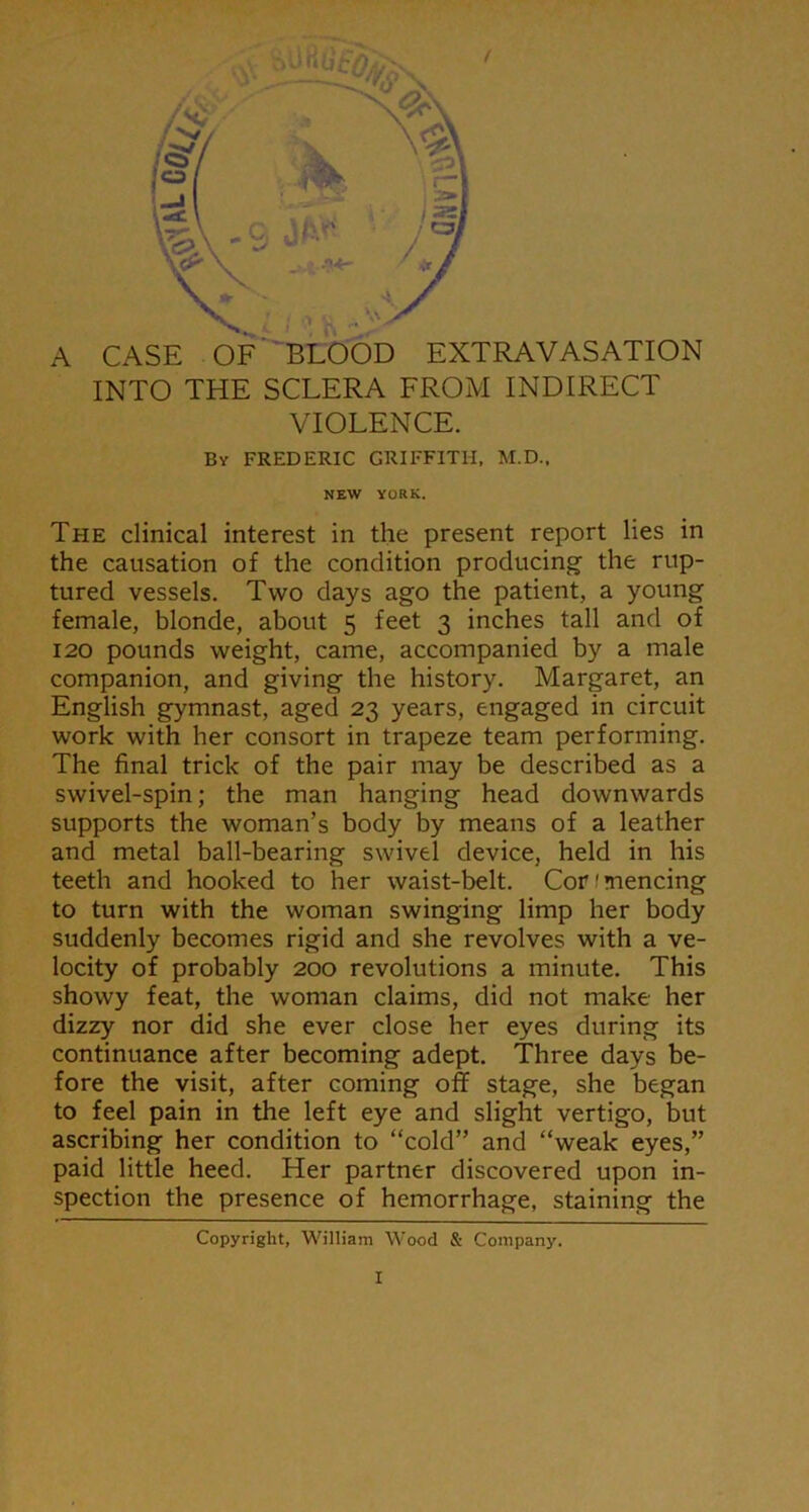 1 \\ A CASE OF BLOOD EXTRAVASATION INTO THE SCLERA FROM INDIRECT VIOLENCE. By FREDERIC GRIFFITH, M.D., NEW YORK. The clinical interest in the present report lies in the causation of the condition producing the rup- tured vessels. Two days ago the patient, a young female, blonde, about 5 feet 3 inches tall and of 120 pounds weight, came, accompanied by a male companion, and giving the history. Margaret, an English gymnast, aged 23 years, engaged in circuit work with her consort in trapeze team performing. The final trick of the pair may be described as a swivel-spin; the man hanging head downwards supports the woman’s body by means of a leather and metal ball-bearing swivel device, held in his teeth and hooked to her waist-belt. Commencing to turn with the woman swinging limp her body suddenly becomes rigid and she revolves with a ve- locity of probably 200 revolutions a minute. This showy feat, the woman claims, did not make her dizzy nor did she ever close her eyes during its continuance after becoming adept. Three days be- fore the visit, after coming off stage, she began to feel pain in the left eye and slight vertigo, but ascribing her condition to “cold” and “weak eyes,” paid little heed. Her partner discovered upon in- spection the presence of hemorrhage, staining the Copyright, William Wood & Company. I