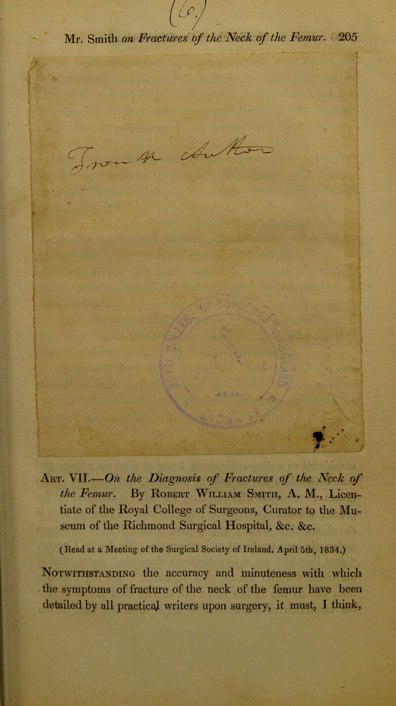 I Mr. Smith on Fractures of the Neck of the Femur. 205 Art. VII.—On the Diagnosis of Fractures of the Neck of the Femur. By Robert William Smith, A. M., Licen- tiate of the Royal College of Surgeons, Curator to the Mu- seum of the Richmond Surgical Hospital, &c. &c. (Read at a Meeting of the Surgical Society of Ireland, April 5th, 1834.) Notwithstanding the accuracy and minuteness with which the symptoms of fracture of the neck of the femur have been detailed by all practical writers upon surgery, it must, I think.