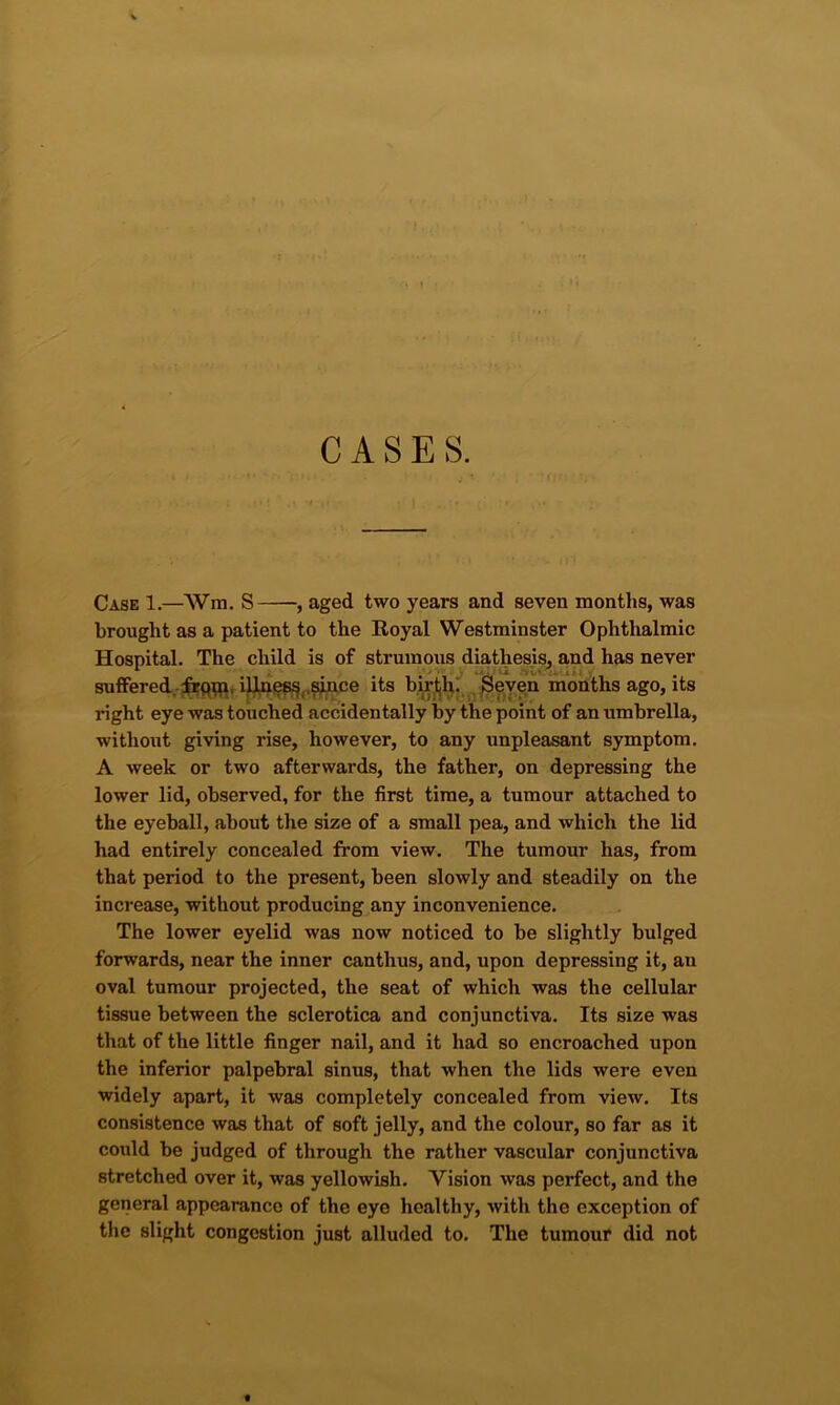 CASES. Case 1.—Wm. S aged two years and seven months, was brought as a patient to the Royal Westminster Ophthalmic Hospital. The child is of strumous diathesis, and has never suffered..-iJJLp^,.^ce its bir^^. ^^eve^ months ago, its right eye was touched accidentally by the point of an umbrella, without giving rise, however, to any unpleasant symptom. A week or two afterwards, the father, on depressing the lower lid, observed, for the first time, a tumour attached to the eyeball, about the size of a small pea, and which the lid had entirely concealed from view. The tumour has, from that period to the present, been slowly and steadily on the increase, without producing any inconvenience. The lower eyelid was now noticed to be slightly bulged forwards, near the inner canthus, and, upon depressing it, an oval tumour projected, the seat of which was the cellular tissue between the sclerotica and conjunctiva. Its size was that of the little finger nail, and it had so encroached upon the inferior palpebral sinus, that when the lids were even widely apart, it was completely concealed from view. Its consistence was that of soft jelly, and the colour, so far as it could be judged of through the rather vascular conjunctiva stretched over it, was yellowish. Vision was perfect, and the general appearance of the eye healthy, with the exception of the slight congestion just alluded to. The tumour did not