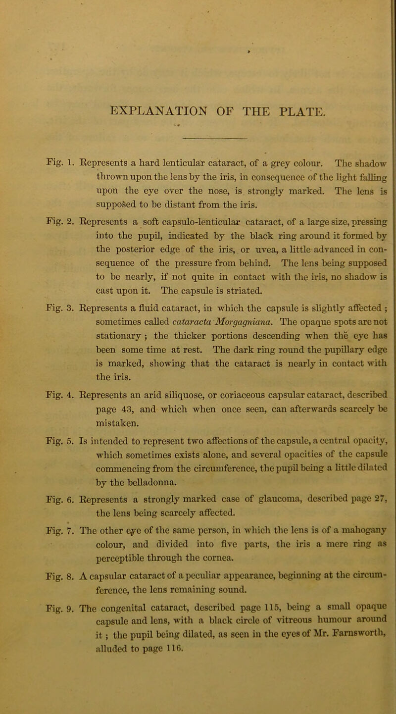 EXPLANATION OF THE PLATE. Fig. 1 Fig. 2 Fig. 3 Fig. 4 Fig. 5 Fig. 6 Fig. 7 Fig. 8 Fig. 9 . Represents a hard lenticular cataract, of a grey colour. The shadow thrown upon the lens by the iris, in consequence of the light falling upon the eye over the nose, is strongly marked. The lens is supposed to be distant from the iris. . Represents a soft capsulo-lenticular cataract, of a large size, pressing into the pupil, indicated by the black ring around it formed by the posterior edge of the iris, or uvea, a little advanced in con- sequence of the pressure from behind. The lens being supposed to be nearly, if not quite in contact with the iris, no shadow is cast upon it. The capsule is striated. . Represents a fluid cataract, in which the capsule is slightly affected ; sometimes called cataracta Morgagniana. The opaque spots are not stationary ; the thicker portions descending when the eye has been some tune at rest. The dark ring round the pupillary edge is marked, showing that the cataract is nearly in contact with the iris. . Represents an arid siliquose, or coriaceous capsular cataract, described page 43, and which when once seen, can afterwards scarcely be mistaken. . Is intended to represent two affections of the capsule, a central opacity, which sometimes exists alone, and several opacities of the capsule commencing from the circumference, the pupil being a little dilated by the belladonna. . Represents a strongly marked case of glaucoma, described page 27, the lens being scarcely affected. . The other eye of the same person, in which the lens is of a mahogany colour, and divided into five parts, the iris a mere ring as perceptible through the cornea, . A capsular cataract of a peculiar appearance, beginning at the circum- ference, the lens remaining sound. . The congenital cataract, described page 115, being a small opaque capsule and lens, with a black circle of vitreous humour around it; the pupil being dilated, as seen in the eyes of Mr. Farnsworth, alluded to page 116.