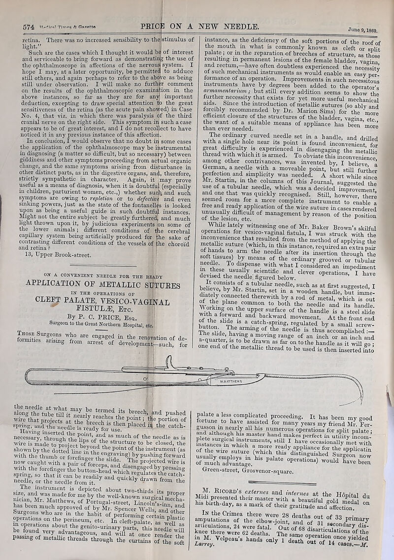 June 9, 1860. retina. There was no increased sensibility to the (stimulus of light.” Such are the cases which I thought it would bej of interest and serviceable to bring forward as demonstrating the use of the ophthalmoscope in affections of the nervous system, hope I may, at a later opportunity, be permitted to adduce still others, and again perhaps to refer to the abo re as beinj still under observation. I will make no further comment on the results of the ophthalmoscopic examination in the above instances, so far as they are for any important deduction, excepting to draw special attention to the great sensitiveness of the retina (as the acute pain showed) in Case No. 4, that viz. in which there was paralysis cf the third cranial nerve on the right side. This symptom in such a case appears to be of great interest, and I do not recol ect. to have noticed it in any previous instance of this affection. In conclusion, I would observe that no doubt in some cases the application of the ophthalmoscope may be instrumental in diagnosing (a matter so difficult, but so necessary) between giddiness and other symptoms proceeding from actual organic change, and the same symptoms arising from disturbance in other distinct parts, as in the digestive organs, and, therefore, strictly sympathetic in character. Again, it ,may prove useful as a means of diagnosis, when it is doubtful (especially in children, parturient women, etc.,) whether such and such symptoms are owing to repletion or to defective and even sinking powers, just as the state of the fontanelles is looked upon as being a useful guide in such doubtful instances. Might not the entire subject be greatly furthered; and much light thrown upon it, by judicious experiments [on some of the lower animals; different conditions of the cerebral capillary system being artificially produced for [he sake of contrasting different conditions of the vessels of the choroid and retina ? 13, Upper Brook-street. ON A CONVENIENT NEEDLE FOR THE READY application op metallic sutures IN THE OPERATIONS OF CLEPT PALATE, VESICO-VAGINAL EISTT7L2E, Etc. By P. c. PRICE, Esq. 1 Surgeon to the Great Northern Hospital, etc. ° 316 engaged “ the rrai°™tion of de- arlsmS flom rest of development-such, for instance, as the deficiency of the soft portions of the roof of the mouth in what is commonly known as cleft or split palate ; or in the reparation of breeches of structure, as those resulting in permanent lesions of the female bladder, vagina and rectum, have often doubtless experienced the necessity of such mechanical instruments as would enable an easy per formance of an operation. Improvements in such necessitous instruments have by degrees been added to the operator's armamentarium; but still every addition seems to show the further necessity that exists for yet more useful mechanical aids. Since the introduction of metallic sutures (so ablv and forcibly recommended by Dr. Marion Sims) for the more efficient closure of the structures of the bladder, vagina etc the want of a suitable means of appliance has been ’more than ever needed. The ordinary curved needle set in a handle, and drUled with a smgle hole near its point is found inconvenient, for great difficulty is experienced in disengaging the metallic thread with which it is armed. To obviate* this °mconv”nience among other contrivances, was invented by, I believe a German, a needle with a moveable point, but still further perfection and simplicity was needed. A short while since Mr. Startm, in the columns of this Sournal, suggested the use of a tubular needle, which was a decided improvement and one that was quickly recognised. Still, however there seemed room for a more complete instrument to enable a free and ready application of the wire suture in cases rendered rf thelesion^tc14 °f management by reason of the position •While lately witnessing one of Mr. Baker Brown's skilful operations for vesico-vagmal fistula, I was struck with the inconvenience that resulted from the method of applying the ShLukTtUle ^Ch> m *lus instance, required a/extapair of hands to arm the needle after its insertion through the needleSUT d'7 mea*1S °{ the ordinalT grooved or tubular fn fho T dl?,pense with what I considered an impediment ^Jh ,e(1 usually scientific and clever operations, I have devised the needle figured below. It consists of a tubular needle, such as at first suggested, I believe, by Mr. Startm, set in a wooden handle, but irnrne- rf the C°,Imected therewith by a rod of metal, which is out °y0S? Plane common to both the needle and its handle. Wdth / a npper surface of the handle is a steel slide of the sliders backwd movement. At the front end button n. patch-spring, regulated by a small screw- The slide ■. ?lnunS the needle is thus accomplished :— louartt’ ‘Tb8 T°™g Tge °f an “ch “ ™ and one end of th teAa'™ aS f“ 0111° the handle as it will go ; one end of the metafile thread to be used is then inserted into aLg th?tube^i it“nTa ‘“T* its breech’ U Pushed wire that projects at P°int ; tbe P“di™ of spring, anS XteMeisereaTyCfof uT ^ * tbe Catcb' necessarf, ttaough^e^ip^o/th asfmutcl1 of the needle as is wire is made to uroiect . A6 stlcture to be closed, the shown by the dotted line tipth* tbe P°'.nt °f the “istrument (as has been much approved of by Mr. Spencer Wells Surgeons who are in the habit of performing certaffi nl *” opeiations on the perineum, etc. In cleft-nalate a* ^\a,stlc U1 operations about the genito-urinary part?,^this imeffie fc be found very advantageous, and will at once rendm TJ11 passing of metafile threads through the Ltaffis of flie soft Jess compficated proceeding. It has been my good loitune to have assisted for many years my friend Mr Fer- gusson m nearly all his numerous operations for split pklate; SHXf Pa'ate °p^> woudd^ave been Green-street, Grosvenor-square. Mi^re^ His bhth-day, as a mark of theh “ In the Crimea there were 28 deaths out nf « „ ■ amputations of the elbow-ioint and „f a, “ 33 primary articulations, 24 were fatal J Our of as 31- s0,c™dary dis- kuee there were 62 deaths.’ The same 00™“^““ °f the m M^eipeau's hands only