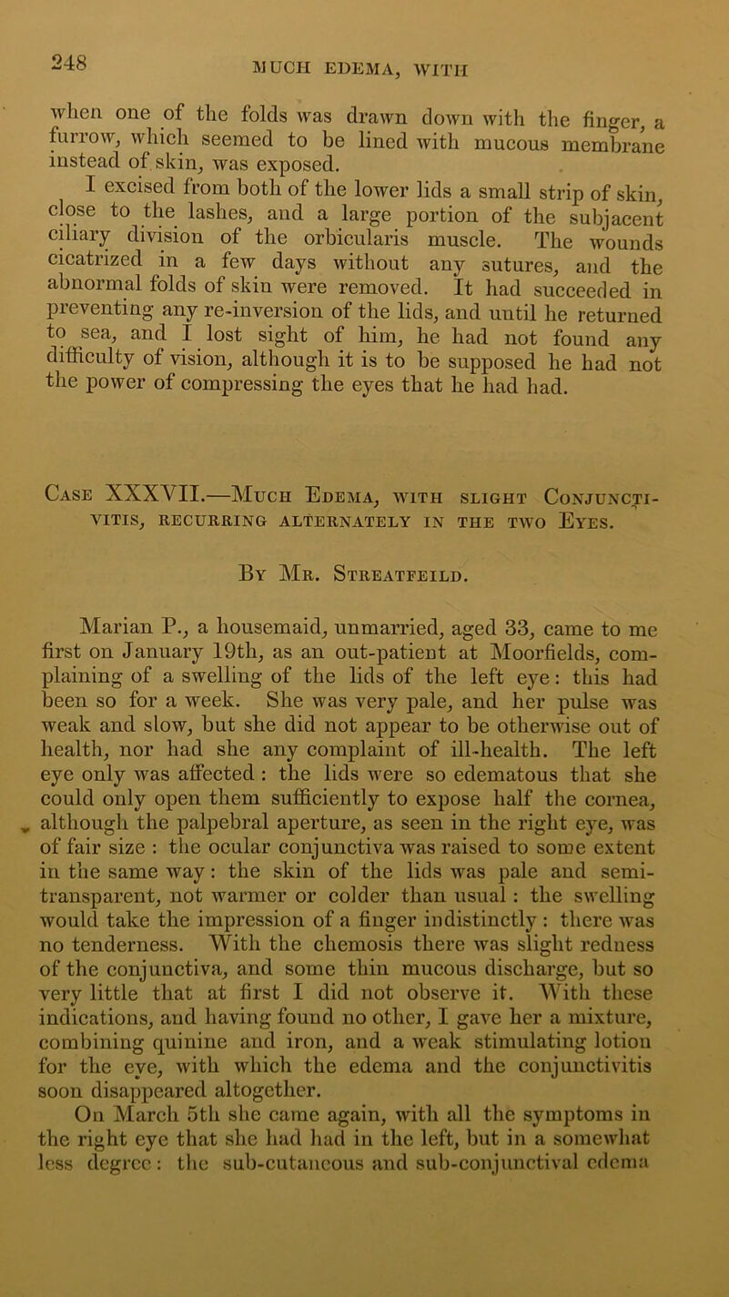 when one of the folds was drawn down with the finger, a furrow, which seemed to be lined with mucous membrane instead of skin, was exposed. I excised from both of the lower lids a small strip of skin, close to the lashes, and a large portion of the subjacent ciliary division of the orbicularis muscle. The wounds cicatrized in a few days without any sutures, and the abnormal folds of skin were removed. It had succeeded in preventing any re-inversion of the lids, and until he returned to sea, and I lost sight of him, he had not found any difficulty of vision, although it is to be supposed he had not the power of compressing the eyes that he had had. Case XXXYII.—Much Edema, WITH SLIGHT CONJUNCTI- VITIS, RECURRING ALTERNATELY IN THE TWO EYES. By Mr. Streatfeild. Marian P., a housemaid, unmarried, aged 33, came to me first on January 19th, as an out-patient at Moorfields, com- plaining of a swelling of the lids of the left eye: this had been so for a week. She was very pale, and her pulse was weak and slow, but she did not appear to be otherwise out of health, nor had she any complaint of ill-health. The left eye only was affected : the lids were so edematous that she could only open them sufficiently to expose half the cornea, „ although the palpebral aperture, as seen in the right eye, was of fair size : the ocular conjunctiva was raised to some extent in the same way: the skin of the lids was pale and semi- transparent, not warmer or colder than usual: the swelling would take the impression of a finger indistinctly : there was no tenderness. With the cliemosis there was slight redness of the conjunctiva, and some thin mucous discharge, but so very little that at first I did not observe it. With these indications, and having found no other, I gave her a mixture, combining quinine and iron, and a weak stimulating lotion for the eye, with which the edema and the conjunctivitis soon disappeared altogether. On March 5th she came again, with all the symptoms in the right eye that she had had in the left, but in a somewhat less degree: the sub-cutaneous and sub-conjunctival edema