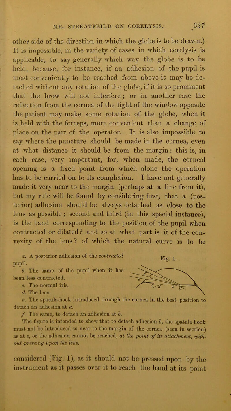 other side of the direction in which the globe is to be drawn.) It is impossible, in the variety of cases in Avhich corelysis is applicable, to say generally which way the globe is to be held, because, for instance, if an adhesion of the pupil is most conveniently to be reached from above it may be de- tached without any rotation of the globe, if it is so prominent that the brow will not interfere; or in another case the reflection from the cornea of the light of the window opposite the patient may make some rotation of the globe, when it is held with the forceps, more convenient than a change of place on the part of the operator. It is also impossible to say where the puncture should be made in the cornea, even at what distance it should be from the margin: this is, in each case, very important, for, when made, the corneal opening is a fixed point from which alone the operation has to be carried on to its completion. I have not generally made it very near to the margin (perhaps at a line from it), but my rule will be found by considering first, that a (pos- terior) adhesion should be always detached as close to the lens as possible; second and third (in this special instance), is the band corresponding to the position of the pupil when contracted or dilated? and so at what part is it of the con- vexity of the lens ? of which the natural curve is to be a. A posterior adhesion of the contracted pupil. b. The same, of the pupil when it has been less contracted. c. The normal iris. d. The lens. e. The spatula-hook introduced through the cornea in the best position to detach an adhesion at a. f. The same, to detach an adhesion at b. The figure is intended to show that to detach adhesion b, the spatula hook must not be introduced so near to the margin of the cornea (seen in section) as at e, or the adhesion cannot be reached, at the point of its attachment, with- out pressing upon the lens. considered (Fig. 1), as it should not be pressed upon by the instrument as it passes over it to reach the band at its point Tig. 1.