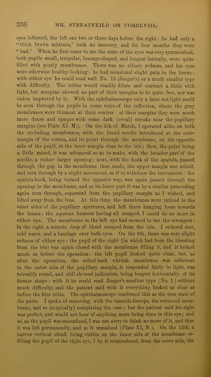 eyes inflamed, the left one two or three days before the right: he had only a “ thick brown mixture,” took no mercury, and for four months they were “ bad. When he fii'st came to me the state of the eyes was very symmetrical, both pupils small, irregular, lozenge-shaped, and longest laterally, were quite filled with pearly membranes. There was no ciliary redness, and his eyes were otherwise healthy-loolcing : he had occasional slight pain in the brows : with either eye he could read well No. 10 (Jaeger’s) or a much smaller type with difiiculty. The irides would readily dilate and contract a little with light, but atropine showed no part of their margins to be quite free, nor was vision improved by it. With the ophthalmoscope only a faint red light could be seen through the pupils in some ways of the reflection, where the gray membranes were thinnest at their centres : at their margins they were much more dense and opaque with some dark (uveal) streaks near the pupillary margins (see Plate XI. M.). On the 5th of March, I operated alike on both the occluding membranes, with the broad needle introduced at the outer margin of the cornea, and its point through the membrane, on the opposite side of the pupil, at the inner margin close to the iris; then, the point being a little raised, it was advanced so as to make, with the broader part’’of the needle, a rather larger opening: next, with the hook of the spatula, passed through the gap in the membrane thus made, the upper margin was seized, and torn through by a slight movement, as if to withdraw the instrument: the spatula-hook, being turned the opposite way, was again passed through the opening in the membrane, and at its lower part it was by a similar proceeding again torn through, separated from the pupillary margin as I wished, and lifted away from the lens. At this time the membranes were retired to the outer sides of the pupillary apertures, and left there hanging loose towards the lenses: the aqueous humour having all escaped, I could do no more in either eye. The membrane in the left eye had seemed to me the strongest: in the right a minute drop of blood escaped from the iris. I ordered rest, cold water, and a bandage over both eyes. On the 8th, there was very slight redness of either eye: the pupil of the right (in which had been the bleeding from the iris) was again closed with the membrane filling it, and it looked much as before the operation: the left pupil looked quite clear, but, as after the operation, the rolled-back whitish membrane was adherent to the outer side of the pupillary margin, it responded fairly to light, was tolerably round, and still showed indication, being longest horizontally, of its former shape : with it he could read Jaeger’s smallest type (No. 1.) without much difficulty, and the patient said with it everything looked as clear as before the first iritis. The ophthalmoscope confirmed this as the true state of the parts. I spoke of removing, with the cannula-forceps, the retracted mem- brane, and so (surgically) completing the case ; but the patient said his sight wras perfect, and would not hear of anything more being done to this eye; and so, as the pupil was unconfined, I was not sorry to think no more of it, and thus it was left permanently, and so it remained (Plate XI, N.). On the 12th, a narrow' vertical chink being visible on the inner side of the membrane re- filling the pupil of the right eye, I by it reintroduced, from the outer side, the