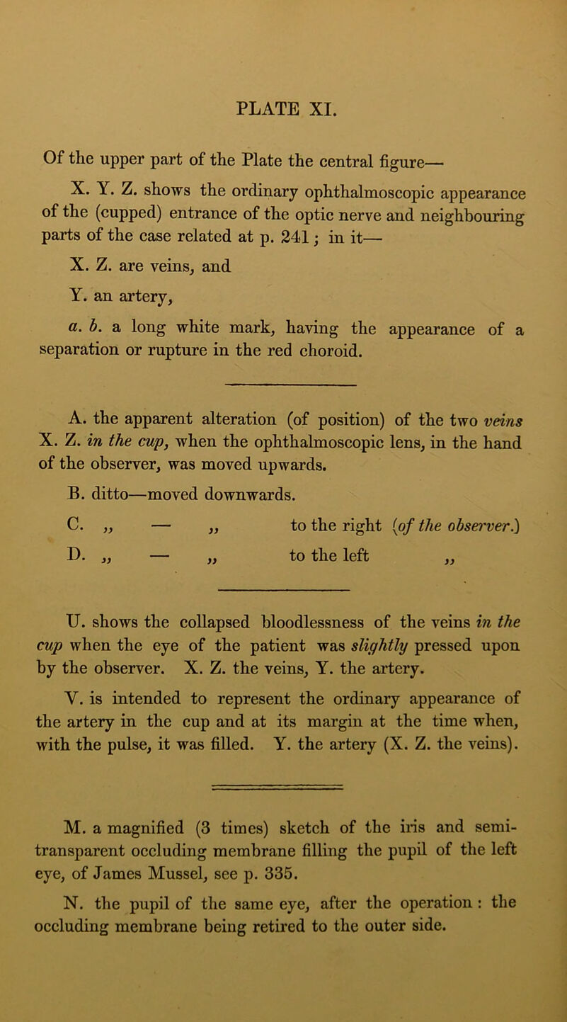 PLATE XI. Of the upper part of the Plate the central figure— X. Y. Z. shows the ordinary ophthalmoscopic appearance of the (cupped) entrance of the optic nerve and neighbouring parts of the case related at p. 241; in it— X. Z. are veins, and Y. an artery, a. b. a long white mark, having the appearance of a separation or rupture in the red choroid. A. the apparent alteration (of position) of the two veins X. Z. in the cup, when the ophthalmoscopic lens, in the hand of the observer, was moved upwards. B. ditto—moved downwards. C. ,, — ,, to the right (of the observer.) D. „ — „ to the left „ U. shows the collapsed bloodlessness of the veins in the cup when the eye of the patient was slightly pressed upon by the observer. X. Z. the veins, Y. the artery. Y. is intended to represent the ordinary appearance of the artery in the cup and at its margin at the time when, with the pulse, it was filled. Y. the artery (X. Z. the veins). M. a magnified (3 times) sketch of the iris and semi- transparent occluding membrane filling the pupil of the left eye, of James Mussel, see p. 335. N. the pupil of the same eye, after the operation : the occluding membrane being retired to the outer side.