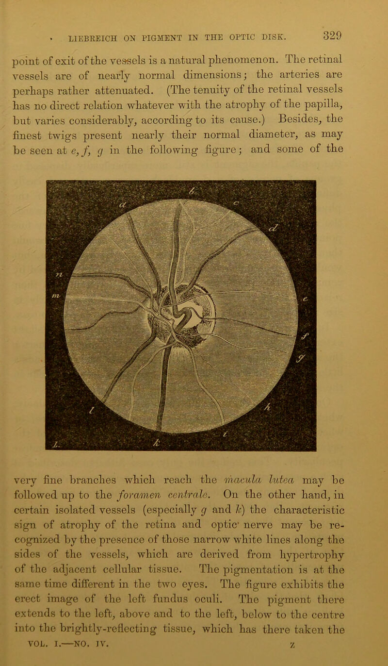 point of exit of the vessels is a natural phenomenon. The retinal vessels are of nearly normal dimensions; the arteries are perhaps rather attenuated. (The tenuity of the retinal vessels has no direct relation whatever with the atrophy of the papilla, but varies considerably, according’ to its cause.) Besides, the finest twigs present nearly their normal diameter, as may be seen at e,/, g in the following figure; and some of the very fine branches which reach the macula lutea may be followed up to the foramen centrdlc. On the other hand, in certain isolated vessels (especially g and 1:) the characteristic sign of atrophy of the retina and optic- nerve may be re- cognized by the presence of those narrow white lines along the sides of the vessels, which are derived from hypertrophy of the adjacent cellular tissue. The pigmentation is at the same time different in the two eyes. The figure exhibits the erect image of the left fundus oculi. The pigment there extends to the left, above and to the left, below to the centre into the brightly-reflecting tissue, which has there taken the VOL. i.—NO. IV. z