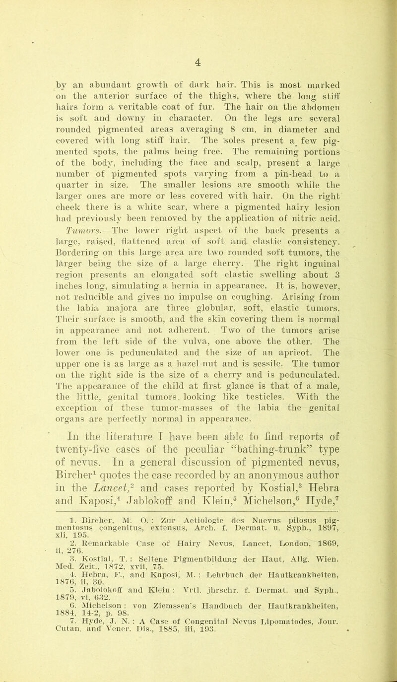 by an abundant growth of dark hair. This is most marked on the anterior surface of the thighs, where the long stiff hairs form a veritable coat of fur. The hair on the abdomen is soft and downy in character. On the legs are several rounded pigmented areas averaging 8 cm. in diameter and covered with long stiff hair. The ’soles present a^ few pig- mented spots, the palms being free. The remaining portions of the body, including the face and scalp, present a large number of pigmented spots varying from a pin-head to a quarter in size. The smaller lesions are smooth while the larger ones are more or less covered with hair. On the right cheek there is a white scar, where a pigmented hairy lesion had previously been removed by the application of nitric acid. Tumors.—T\\e lower right aspect of the back presents a large, raised, flattened area of soft and elastic consistency. Bordering on this large area are two rounded soft tumors, the larger being the size of a large cherry. The right inguinal region presents an elongated soft elastic swelling about 3 inches long, simulating a hernia in appearance. It is, however, not reducible and gives no impulse on coughing. Arising from the labia majora are three globular, soft, elastic tumors. Their surface is smooth, and the skin covering them is normal in appearance and not adherent. Two of the tumors arise from the left side of the vulva, one above the other. The lower one is pedunculated and the size of an apricot. The upper one is as large as a hazel-nut and is sessile. The tumor on the right side is the size of a cherry and is pedunculated. The appearance of the child at first glance is that of a male, the little, genital tumors, looking like testicles. With the exception of these tumor-masses of the labia the genital organs are perfectly normal in appearance. In the literature I have been able to find reports of twenty-five cases of the peculiar ^^bathing-trunk’’ type of nevus. In a general discussion of pigmented nevus, Bircher^ quotes the case recorded by an anonymous author in the Lancet,^ and cases reported by Kostial,® Hebra and Kaposi,^ Jablokofi and Klein/ Michelson/ Hyde/ 1. Birclier, M. O. : Zur Aetiologie des Naevus pilosus pig- mentosus congenitus, extensus, Arch. f. Dermat. u. Syph., 1897, xli, 195. 2. Remarkable Case of Hairy Nevus, Hancet, London, 1869, ii, 276. 3. Kostial, T. : Seltene Pigmentbildung der Haut, Allg. Wien. Med. Zeit., 1872, xvii, 75. 4. Hebra, F., and Kaposi, M. : Lebrbuch der Hautkrankbeiten, 1876, ii, 30. 5. Jabolokoff and Klein : Vrtl. jhrscbr. f. Dermat. und Svpb., 1879, Vi, 632. 6. Michelson : von Ziemssen’s Handbuch der Hautkrankbeiten, 1884, 14-2, p. 98. 7. Hyde, .J. N. : A Case of Congenital Nevus Lipomatodes, Jour. Cutan. and Vener. Dis., 1885, iii, 193.