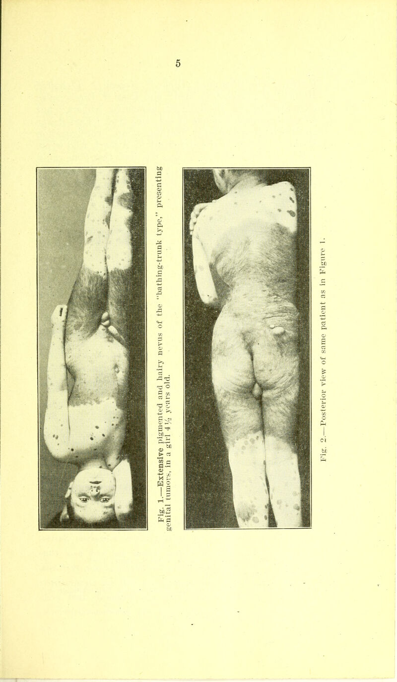 Posterior view of same patient as in Figure