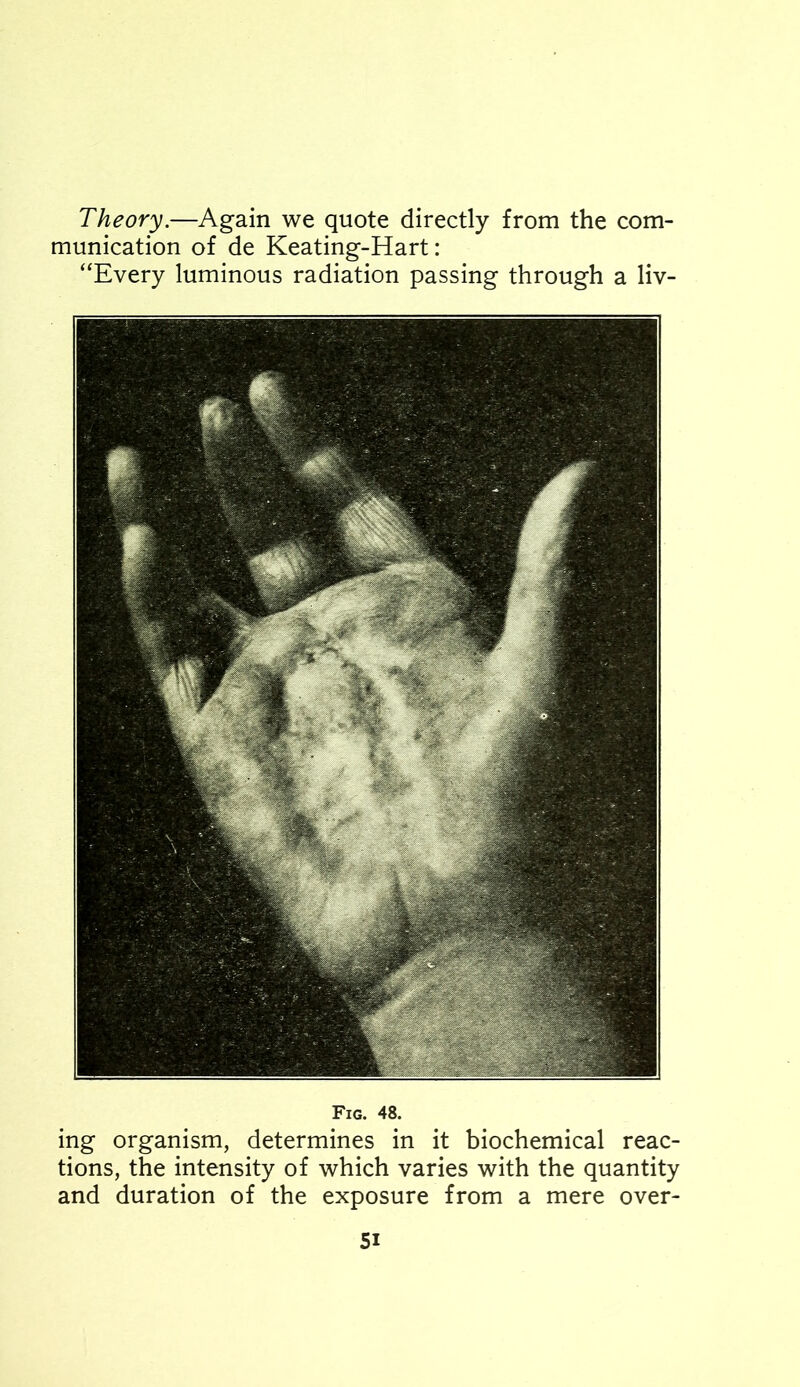 Theory.—Again we quote directly from the com- munication of de Keating-Hart: “Every luminous radiation passing through a liv- Fig. 48. ing organism, determines in it biochemical reac- tions, the intensity of which varies with the quantity and duration of the exposure from a mere over-