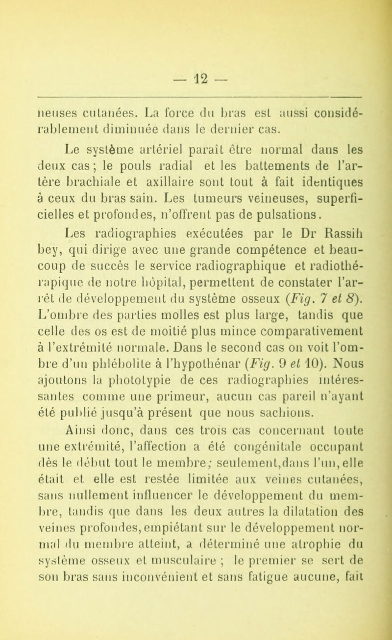 lieuses ciUauées. La force du bras esL aussi cousidé- rablemeuL dimiuuée dans le dernier cas. Le système artériel paraît être normal dans les deux cas ; le poids radial et les battements de l’ar- tère brachiale et axillaire sont tout à fait identiques à ceux du bras sain. Les tumeurs veineuses, superfi- cielles et profondes, n’olïrent pas de pulsations. Les radiographies exécutées par le Dr Rassili bey, qui dirige avec une grande compétence et beau- coup de succès le service radiographique et radiothé- rapique de notre hôpital, permettent de constater l’ar- rêt de développement du système osseux {Fig. 7 el 8). L’ombre des pai ties molles est plus large, tandis que celle des os est de moitié plus mince comparativement à l’extrémité normale. Dans le second cas on voit l’om- bre d’un phlébolite à l’hypothénar (Fig. 9 et 10). Nous ajoutons la pbototypie de ces radiographies intéi’es- santes comme une primeur, aucun cas pareil n’ayant été publié jusqu’à présent que nous sachions. Ainsi donc, dans ces trois cas conceiiiant toute une extrémité, l’alïection a été congénitale occupant dès le début tout le membre; seulement,dans l’un,elle était et elle est restée limitée aux veines cutanées, sans nullement inlluencer le développement du mem- bre, tandis que dans les deux autres la dilatation des veines profondes,empiétant sur le développement nor- mal du membre atteint, a déterminé une ati’opbie du sysiéme osseux et musculaii’e ; le premier se sert de son bras sans inconvénient et sans fatigue aucune, fait