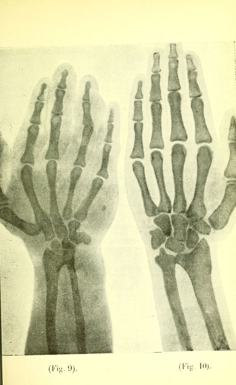 (Fi^. 9). (Fig. 10).