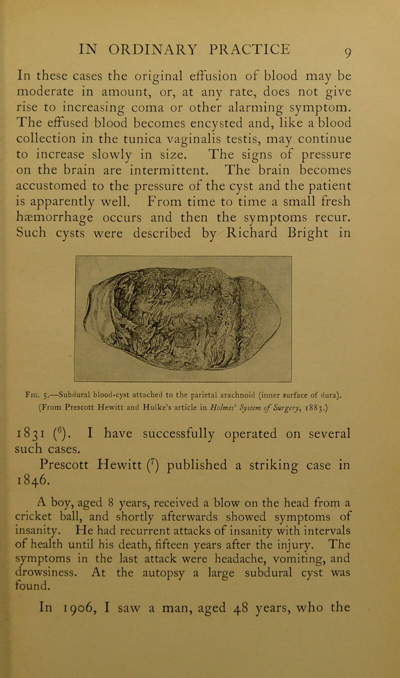 In these cases the original effusion of blood may be moderate in amount, or, at any rate, does not give rise to increasing coma or other alarming symptom. The effused blood becomes encysted and, like a blood collection in the tunica vaginalis testis, may continue to increase slowly in size. The signs of pressure on the brain are intermittent. The brain becomes accustomed to the pressure of the cyst and the patient is apparently well. From time to time a small fresh haemorrhage occurs and then the symptoms recur. Such cysts were described by Richard Bright in Fig. 5.—Subdural blood-cyst attached to the parietal arachnoid (inner surface of dura). (From Prescott Hewitt and Hulke’s article in Holmes’ System of Surgery, 1883.) 1831 (6). I have successfully operated on several such cases. Prescott Hewitt (7) published a striking case in 1846. A boy, aged 8 years, received a blow on the head from a cricket ball, and shortly afterwards showed symptoms of insanity. He had recurrent attacks of insanity with intervals of health until his death, fifteen years after the injury. The symptoms in the last attack were headache, vomiting, and drowsiness. At the autopsy a large subdural cyst was found. In 1906, I saw a man, aged 48 years, who the