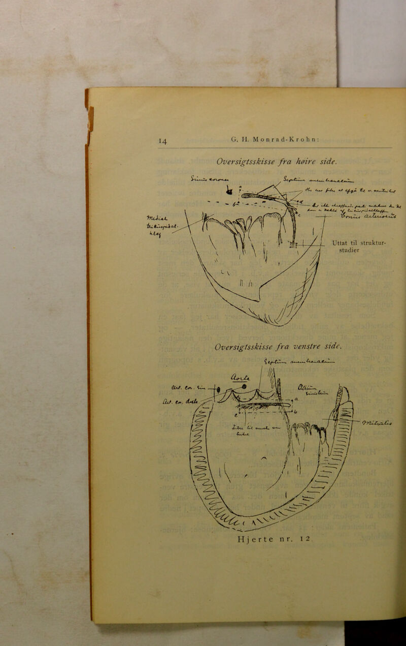 I, H G. H. Monrad-Krohn Oversigtsskisse fra høire side. ^,4.^ 1«^ <C4, ^./. A* SLf Uttat til struktur- studier Oversigtsskisse fra venstre side.