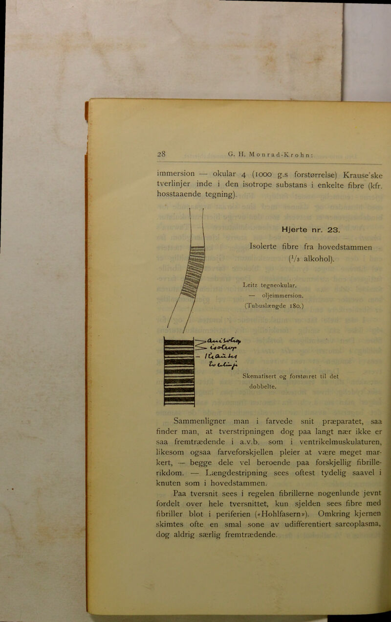 immersion — okular 4 (1000 g.s forstørrelse) Krause’ske tverlinjer inde i den isotrope substans i enkelte fibre (kfr. hosstaaende tegning). Hjerte nr. 23. Isolerte fibre fra hovedstammen (Vs alkohol). Leitz tegneokular. — oljeimmersion. (Tubuslængde 180.) CéO’Cctrf Skematisert og forstøiret til det dobbelte. Sammenligner man i farvede snit præparatet, saa finder man, at tverstripningen dog paa langt nær ikke er saa fremtrædende i a.v.b. som i ventrikelmuskulaturen, likesom ogsaa farveforskjellen pleier at være meget mar- kert, — begge dele vel beroende paa forskjellig fibrille- rikdom. — Længdestripning sees oftest tydelig saavel i knuten som i hovedstammen. Paa tversnit sees i regelen fibrillerne nogenlunde jevnt fordelt over hele tversnittet, kun sjelden sees fibre med fibriller blot i periferien («Hohlfasern»). Omkring kjernen skimtes ofte. en smal sone av udififerentiert sarcoplasma, dog aldrig særlig fremtrædende.