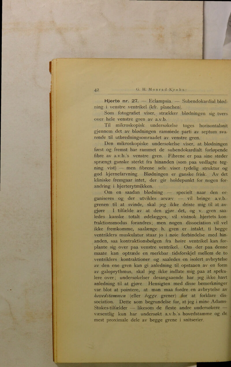 Hjerte nr. 27. — Eclampsia. — Subendokardial, blød- ning i venstre ventrikel (kfr. planchen). Som fotografiet viser, strækker blødningen sig tvers over hele venstre gren av a.v.b. Til mikroskopisk undersøkelse toges horisontalsnit gjennem det av blødningen ramrriede parti av septum sva- rende til utbredningsomraadet av venstre gren. Den mikroskopiske undersøkelse viser, at blødningen først og fremst har rammet de subendokardialt forløpende fibre av a.v.b.’s venstre gren. Fibrene er paa sine steder sprængt ganske sterkt fra hinanden (som paa vedlagte teg- ning vist) — men fibrene selv viser tydelig struktur og god kjernefarvning. Blødningen er ganske frisk. Av det kliniske fremgaar intet, der gir holdepunkt for nogen for- andring i hjerterytmikken. Om en saadan blødning — specielt naar den or- ganiseres og der utvikles arvæv — vil bringe a.v.b.- grenen til at svinde, skal jeg ikke driste mig til at av- gjøre I tilfælde av at den gjør det, og v. gren saa- ledes kanske totalt ødelægges, vil vistnok hjertets kon- fraktionsmodus forandres; men nogen dissociation vil vel ikke fremkomme, saalænge h. gren er intakt, ti begge ventriklers muskulatur staar jo i nøie forbindelse med hin- anden, saa kontraktionsbølgen fra høire ventrikel kan for- plante sig over paa venstre ventrikel. Om der paa denne maate kan optræde en merkbar tidsforskjel mellem de to ventriklers kontraktioner og saaledes en isolert avbrytelse av den ene gren kan gi anledning til opstaaen av en form av galoprythmus, skal jeg ikke indlate mig paa at speku- lere over; undersøkeiser desangaaende har jeg ikke havt anledning til at gjøre. Hensigten med disse bemerkninger var blot at pointere, at man maa fordre en avbrytelse av hovedstammen (eller begge grener) for at forklare dis- sociation. Dette som begrundelse for, at jeg i mine Adams- Stokes-tilfælder — likesom de fleste andre undersøkere — væsentlig kun har undersøkt a.v.b.’s hovedstamme og de mest proximale dele av begge grene i snitserier.