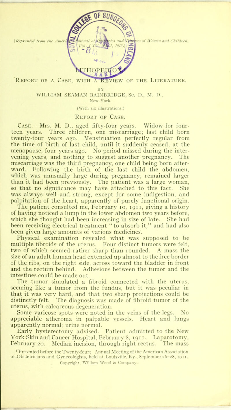 WILLIAM SEAMAN BAINBRIDGE, Sc. D., M. D., New York. (With six illustrations.) Report of Case. Case.—Mrs. M. D., aged fifty-four years. Widow for four- teen years. Three children, one miscarriage; last child born twenty-four years ago. Menstruation perfectly regular from the time of birth of last child, until it suddenly ceased, at the menopause, four years ago. No period missed during the inter- vening years, and nothing to suggest another pregnancy. The miscarriage was the third pregnancy, one child being born after- ward. Following the birth of the last child the abdomen, which was unusually large during pregnancy, remained larger than it had been previously. The patient was a large woman, so that no significance may have attached to this fact. She was always well and strong, except for some indigestion, and palpitation of the heart, apparently of purely functional origin. The patient consulted me, February io, 1911, giving a history of having noticed a lump in the lower abdomen two years before, which she thought had been increasing in size of late. She had been receiving electrical treatment “to absorb it,” and had also been given large amounts of various medicines. Physical examination revealed what was supposed to be multiple fibroids of the uterus. Four distinct tumors were felt, two of which seemed rather sharp than rounded. A mass the size of an adult human head extended up almost to the free border of the ribs, on the right side, across toward the bladder in front and the rectum behind. Adhesions between the tumor and the intestines could be made out. The tumor simulated a fibroid connected with the uterus, seeming like a tumor from the fundus, but it was peculiar in that it was very hard, and that two sharp projections could be distinctly felt. The diagnosis was made of fibroid tumor of the uterus, .with calcareous degeneration. Some varicose spots were noted in the veins of the legs. No appreciable atheroma in palpable vessels. Heart and lungs apparently normal; urine normal. Early hysterectomy advised. Patient admitted to the New York Skin and Cancer Hospital, February S, 1911. Laparotomy, February 20. Median incision, through right rectus. The mass 1 Presented before the Twenty-fourt Annual Meeting of the American Association of Obstetricians and Gynecologists, held at Louisville, Ky., September 26-28, 1911. Copyright, William Wood & Company.