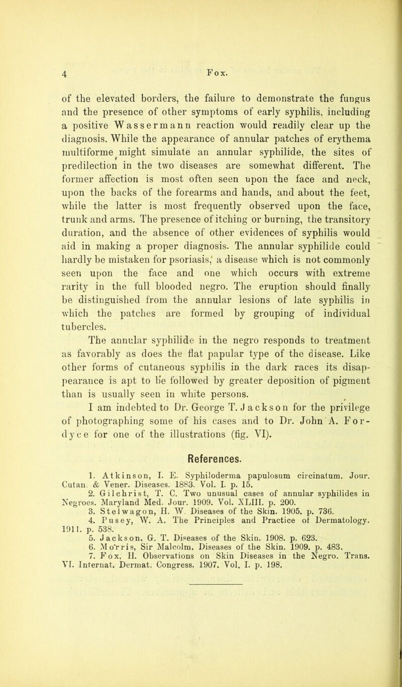 of the elevated borders, the failure to demonstrate the fungus and the presence of other symptoms of early syphilis, including a positive Wassermann reaction would readily clear up the diagnosis. While the appearance of annular patches of erythema multiforme ^ might simulate an annular syphilide, the sites of predilection in the two diseases are somewhat different. The former affection is most often seen upon the face and neck, upon the backs of the forearms and hands, and about the feet, while the latter is most frequently observed upon the face, trunk and arms. The presence of itching or burning, the transitory duration, and the absence of other evidences of syphilis would aid in making a proper diagnosis. The annular syphilide could hardly be mistaken for psoriasis,’ a disease which is not commonly seen upon the face and one which occurs with extreme rarity in the full blooded negro. The eruption should finally be distinguished from the annular lesions of late syphilis in which the patches are formed by grouping of individual tubercles. The annular syphilide in the negro responds to treatment as favorably as does the flat papular type of the disease. Like other forms of cutaneous syphilis in the dark races its disap- pearance is apt to lie followed by greater deposition of pigment than is usually seen in white persons. I am indebted to Dr. George T. Jackson for the privilege of photographing some of his cases and to Dr. John A. For- dyce for one of the illustrations (fig. VI). References. 1. Atkinson, I. E. Syphiloderma papulosum circinatum. Jour. Cutan, & Vener. Diseases. 1883. Vol. I. p. 15. 2. Gilchrist, T. C. Two unusual cases of annular syphilides in Negroes. Maryland Med. Jour. 1909. Vol. XLIII. p. 200. 3. Steiwagon, H. W. Diseases of the Skin. 1905. p. 736. 4. Pusey, W. A. The Principles and Practice of Dermatology. 1911. p. 538. 5. Jackson, G. T. Diseases of the Skin. 1908. p. 623. 6. Mo'rris, Sir Malcolm. Diseases of the Skin. 1909. p. 483. 7. Fox, II. Observations on Skin Diseases in the Negro. Trans. VI. Internat. Dermat. Congress. 1907. Vol. I. p. 198.