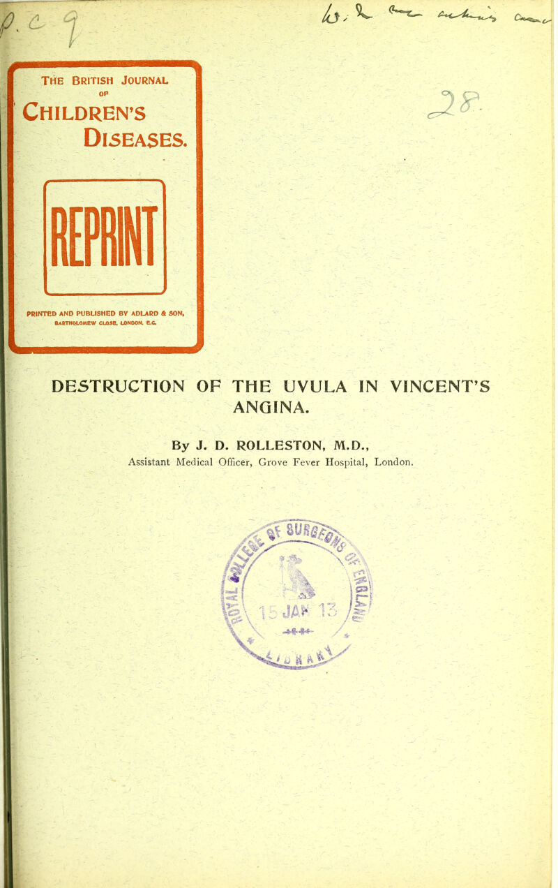 1 ^ pmmmmmmmmmmmmmmmm tSe British Journal OP CHILDREN’S Diseases. PRINTED AND PUBLISHED BY ADLARD & SON. BABTHOtOMEW CU>5B. LONDON. B.C DESTRUCTION OF THE UVULA IN VINCENT’S j ANGINA. ‘ By J, D. ROLLESTON, M.D., Assistant Medical Officer, Grove Fever Hospital, London. |'j