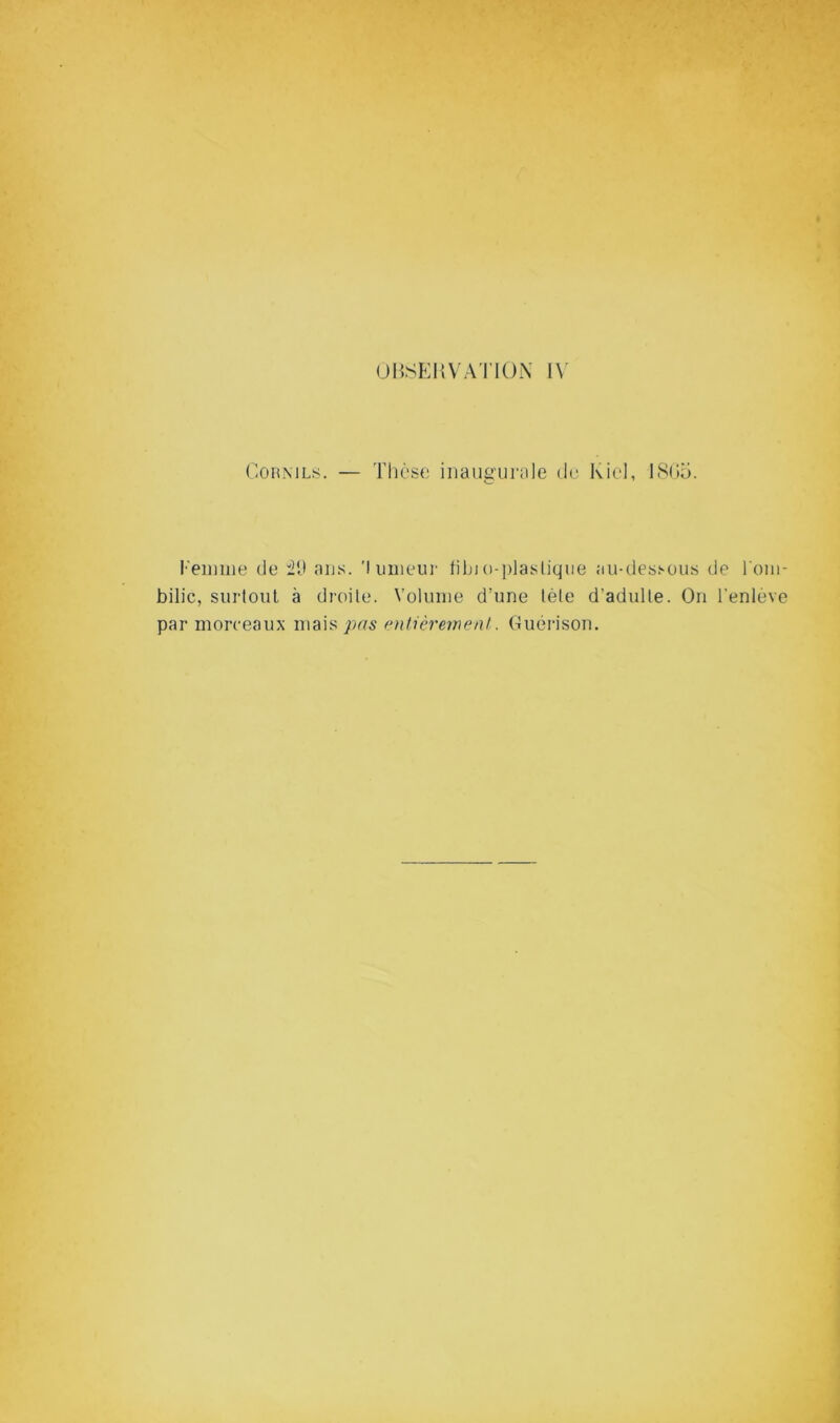 OHSEItVATlüN I\ C0HML8. — Thèse iiiaua'urnle de Kiel, 18(»5. O ’ de i\) aus. 'luiiieui' fibi()-{)lasliqiie au-dessous de l'oui- bilic, surloul à droite. Volume d’une tète d’adulte. On l’enleve par morceaux mais entièrement. Guérison.