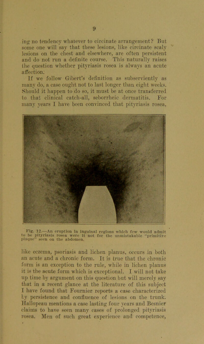 ing no tendency whatever to circinate arrangement ? But some one will say that these lesions, like circinate scaly lesions on the chest and elsewhere, are often persistent and do not run a definite course. This naturally raises the question whether pityriasis rosea is always an acute affection. If we follow Gibert’s definition as subserviently as many do, a case ought not to last longer than eight weeks. Should it happen to do so, it must be at once transferred to that clinical catch-all, seborrheic dermatitis. For many years I have been convinced that pityriasis rosea, Fig. 12.—-An eruption in inguinal regions which few would admit to be pityriasis rosea were it not for the unmistakable “primitive plaque” seen on the abdomen. like eczema, psoriasis and lichen planus, occurs in both an acute and a chronic form. It is true that the chronic form is an exception to the rule, while in lichen planus it is the acute form which is exceptional. I will not take up time by argument on this question but will merely say that in a recent glance at the literature of this subject I have found that Fournier reports a case characterized by persistence and confluence of lesions on the trunk. Hallopeau mentions a case lasting four years and Besnicr claims to have seen many cases of prolonged pityriasis rosea. Men of such great experience and competence,