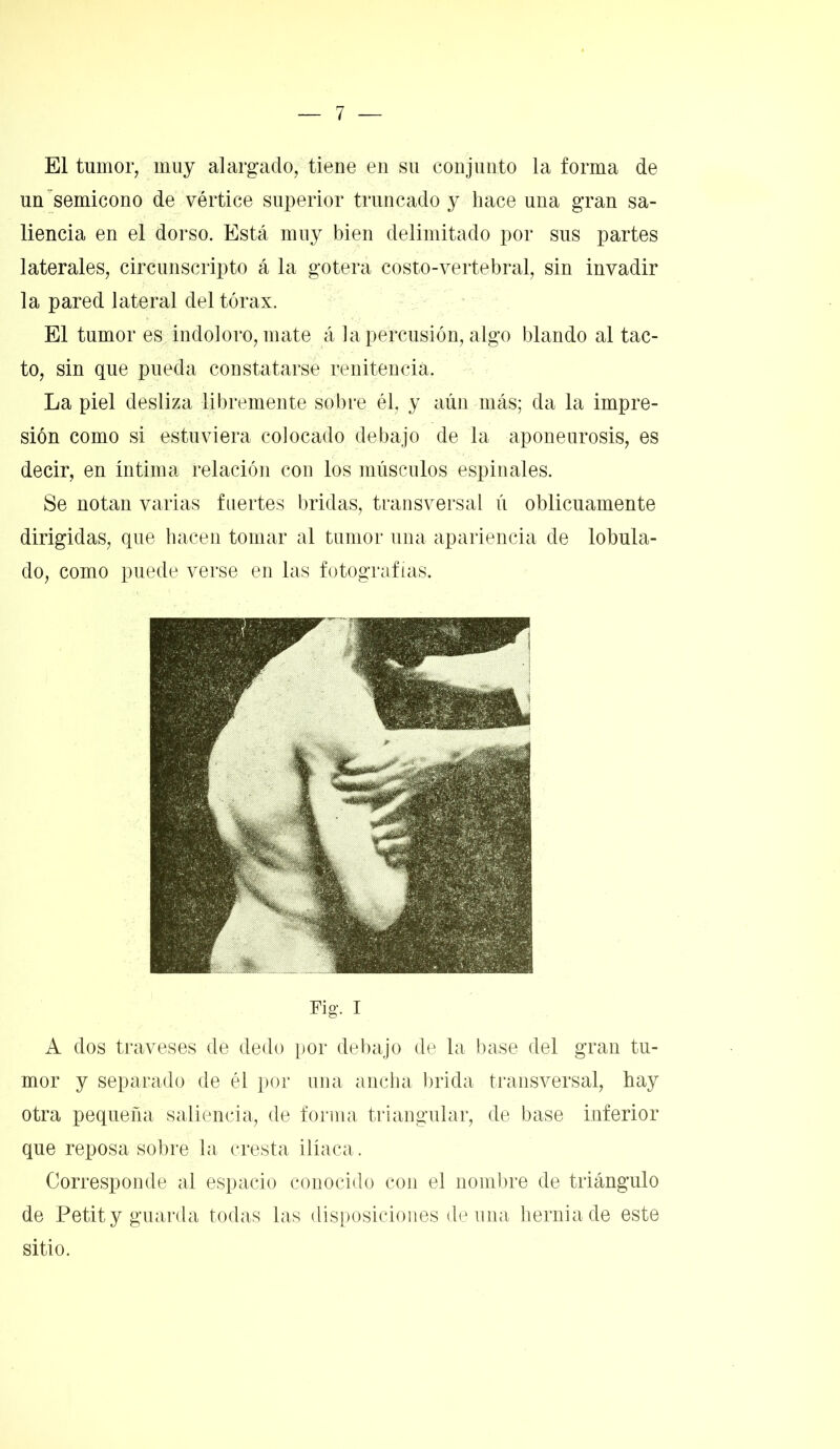 El tumor, muy alargado, tiene en su conjunto la forma de un semicono de vértice superior truncado y hace una gran sa- liencia en el dorso. Está muy bien delimitado por sus partes laterales, circunscripto á la gotera costo-vertebral, sin invadir la pared lateral del tórax. El tumor es indoloro, mate á la percusión, algo blando al tac- to, sin que pueda constatarse renitencia. La piel desliza libremente sobre, él, y aún más; da la impre- sión como si estuviera colocado debajo de la aponeurosis, es decir, en íntima relación con los músculos espinales. Se notan varias fuertes bridas, transversal ú oblicuamente dirigidas, que hacen tomar al tumor una apariencia de lobula- do, como puede verse en las fotografías. Fig. I A dos traveses de dedo por debajo de la base del gran tu- mor y separado de él por una ancha brida transversal, hay otra pequeña saliencia, de forma triangular, de base inferior que reposa sobre la cresta ilíaca. Corresponde al espacio conocido con el nombre de triángulo de Petit y guarda todas las disposiciones de una bernia de este sitio.