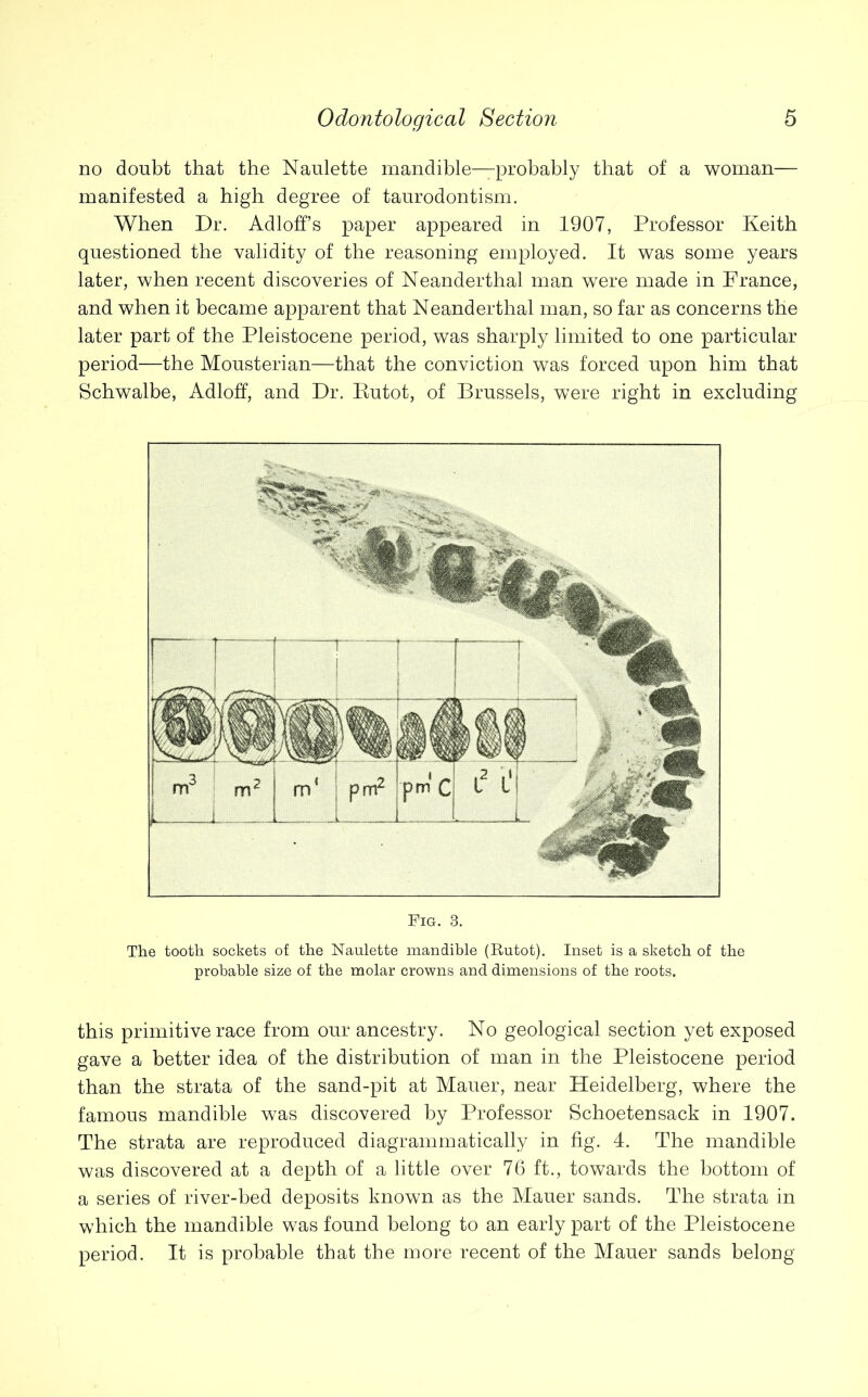 no doubt that the Naulette mandible—probably that of a woman— manifested a high degree of taurodontism. When Dr. Adloff’s paper appeared in 1907, Professor Keith questioned the validity of the reasoning employed. It was some years later, when recent discoveries of Neanderthal man were made in France, and when it became apparent that Neanderthal man, so far as concerns the later part of the Pleistocene period, was sharply limited to one particular period—the Mousterian—that the conviction was forced upon him that Schwalbe, Adloff, and Dr. Putot, of Brussels, were right in excluding Fig. 3. The tooth sockets of the Naulette mandible (E-utot). Inset is a sketch of the probable size of the molar crowns and dimensions of the roots. this primitive race from our ancestry. No geological section yet exposed gave a better idea of the distribution of man in the Pleistocene period than the strata of the sand-pit at Mauer, near Heidelberg, where the famous mandible was discovered by Professor Schoetensack in 1907. The strata are reproduced diagrammatically in fig. 4. The mandible was discovered at a depth of a little over 76 ft., towards the bottom of a series of river-bed deposits known as the Mauer sands. The strata in which the mandible was found belong to an early part of the Pleistocene period. It is probable that the more recent of the Mauer sands belong