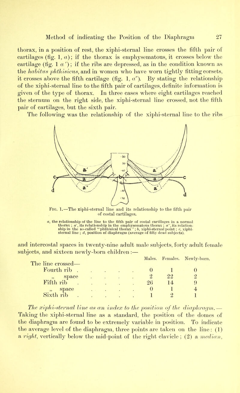 thorax, in a position of rest, the xiphi-sternal line crosses the fifth pair of cartilages (fig. 1 ,a)\ if the thorax is emphysematous, it crosses below the cartilage (fig. 1 a'); if the ribs are depressed, as in the condition known as the habitus phthisicus, and in women who have worn tightly fitting corsets, it crosses above the fifth cartilage (fig. 1, a). By stating the relationship of the xiphi-sternal line to the fifth pair of cartilages, definite information is given of the type of thorax. In three cases where eight cartilages reached the sternum on the right side, the xiphi-sternal line crossed, not the fifth pair of cartilages, but the sixth pair. The following was the relationship of the xiphi-sternal line to the ribs of costal cartilages. a, the relationship of the line to the fifth pair of costal cartilages in a normal thorax ; a', its relationship in the emphysematous thorax ; a, its relation- ship in the so-called “phthisical thorax ’’; b, xiphi-sternal point; c, xiphi- sternal line ; d, position of diaphragm (average of fifty dead subjects). and intercostal spaces in twenty-nine adult male subjects, forty adult female subjects, and sixteen newly-born children:— The line crossed— Fourth rib . „ space Fifth rib „ space Sixth rib Males. Females. Newly-born. 0 1 0 2 22 2 26 14 9 0 14 1 2 1 The xiphi-sternal line as an index to the position of the diaphragm. — Taking the xiphi-sternal line as a standard, the position of the domes of the diaphragm are found to be extremely variable in position. To indicate the average level of the diaphragm, three points are taken on the line: (1) a right, vertically below the mid-point of the right clavicle ; (2) a median,