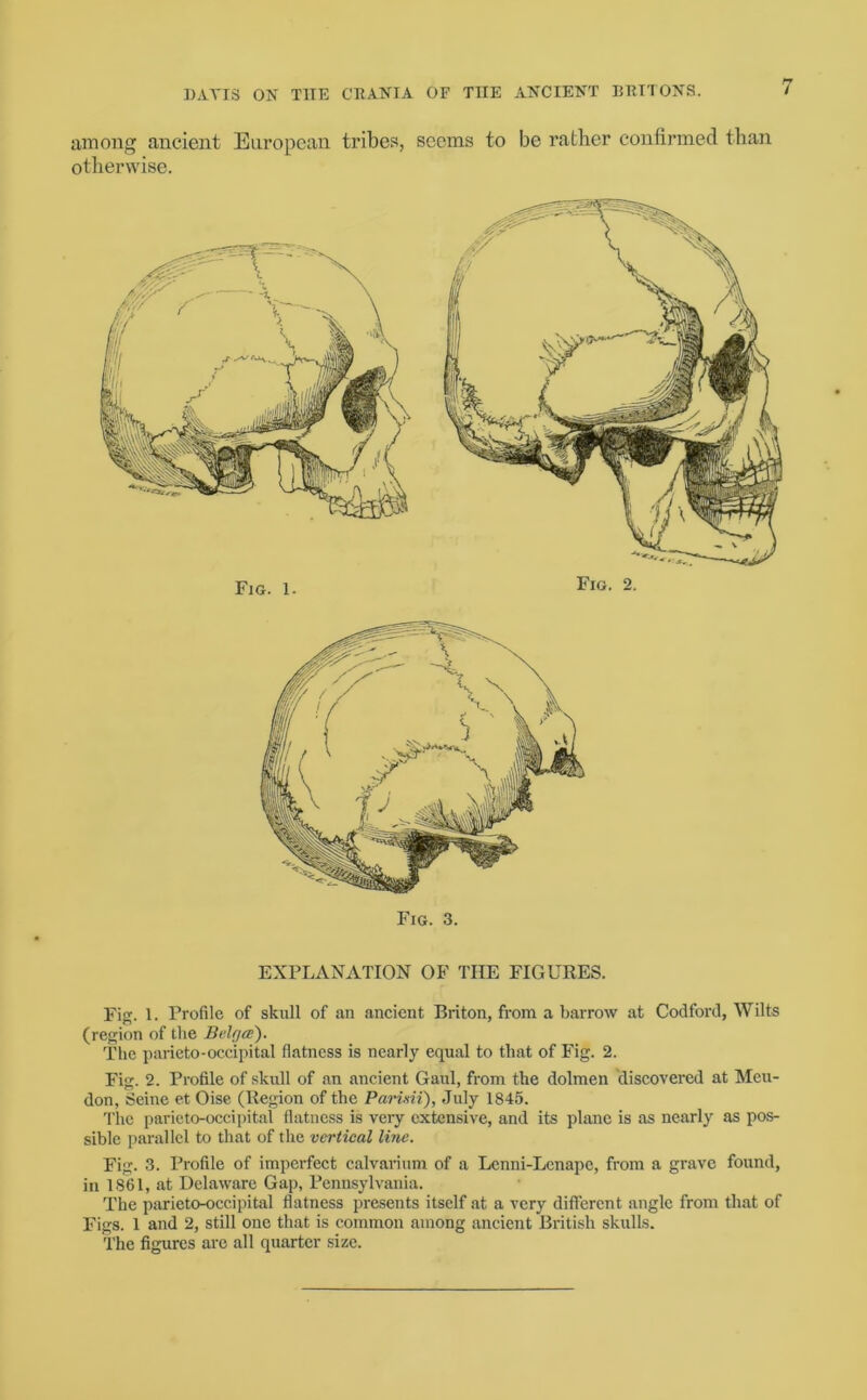 among ancient European tribes, seems to be rather confirmed than otherwise. Fig. 1. Fig. 2. Fig. 3. EXPLANATION OF THE FIGURES. Fig. 1. Profile of skull of an ancient Briton, from a barrow at Codford, Wilts (region of the Belrjai). The parieto-occipital flatness is nearly equal to that of Fig. 2. Fig. 2. Profile of skull of an ancient Gaul, from the dolmen discovered at Meu- don, Seine et Oise (Region of the Parlni), July 1845. The parieto-occipital flatness is very extensive, and its plane is as nearly as pos- sible parallel to that of the vertical line. Fig. 3. Profile of imperfect calvarium of a Lenni-Lenape, from a grave found, in 1861, at Delaware Gap, Pennsylvania. The parieto-occipital flatness presents itself at a very different angle from that of Figs. 1 and 2, still one that is common among ancient British skulls. The figures are all quarter size.
