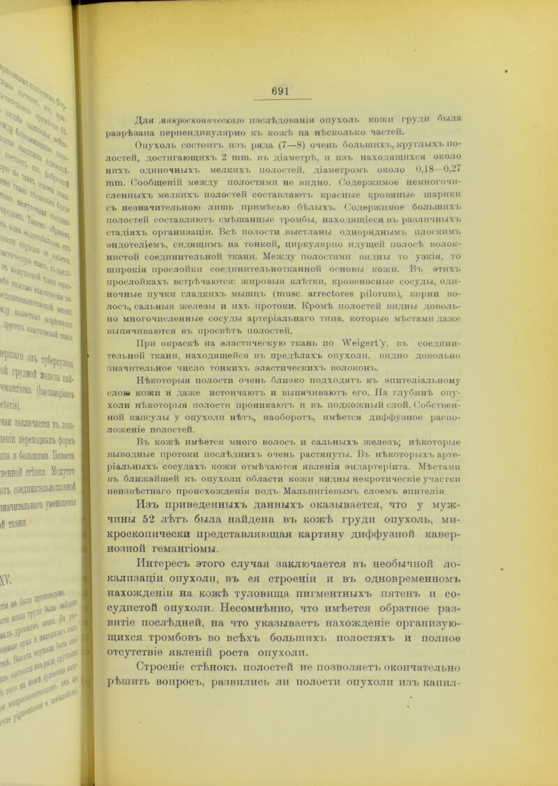 V Ч чч ч,х;чч Ч>Сч 1/°хчС^ % ,.г ‘ Ч ,, %|. <>>*- N „ Ѵ> .2* Ць Ч V - %, Ноотті мт^іа.імі ч% «у» не ^ѵт, °чпой ТОЛСТЫЯ аі, * 9ластііЧ( «ѣе ’^ьнотк, ^ Гостями всм,  Ч®» »П П(«рК;в1 0 гР)ДНой железы пай- сманпома (кетапаогаа іСІОГІЗ). чая заключается въ лока- іеніи переходныхъ формъ ша и большими. Полости. отъ значительнаго уменьшенія ій ткани. II *»*•*% аадъ Н11 іОВ^ ,овне«ъ В . какъ ,*<И ТОГ® 1 ѵшн №0 1 691 Для микроскопическаго изслѣдованія опухоль кожи груди оыла разрѣзана перпендикулярно къ кожѣ на нѣсколько частей. Опухоль состоитъ изъ ряда (7—8) очень большихъ, круглыхъ по- лостей, достигающихъ 2 шт, въ діаметрѣ, и изъ находящихся около нихъ одиночныхъ мелкихъ полостей, діаметромъ около 0,18—0,27 шт. Сообщеній между полостями не видно. Содержимое немногочи- сленныхъ мелкихъ полостей составляютъ красные кровяные шарики съ незначительною лишь примѣсью бѣлыхъ. Содержимое большихъ полостей составляютъ смѣшанные тромбы, находящіеся въ различных-], стадіяхъ организаціи. Всѣ полости выстланы одноряднымъ плоскимъ эндотеліемъ, сидящимъ на тонкой, циркулярно идущей полосѣ волок- нистой соединительной ткани. Между полостями видны то узкія, то широкія прослойки соединительнотканной основы кожи. Въ этихъ прослойкахъ встрѣчаются: жировыя клѣтки, кровеносные сосуды, оди- ночные пучки гладкихъ мышцъ (тизс. аггесіогез рііогит), корни во- лосъ, сальныя железы и ихъ протоки. Кромѣ полостей видны доволь- но многочисленные сосуды артеріальнаго типа, которые мѣстами даже выпячиваются въ просвѣтъ полостей. При окраскѣ на эластическую ткань по \Ѵеі§ет1’у, въ соедини- тельной ткани, находящейся въ предѣлахъ опухоли, видно довольно значительное число тонкихъ эластическихъ волоконъ. Нѣкоторыя полости очень близко подходятъ къ эпителіальному слою кожи и даже истончаютъ и выпячиваютъ его. На глубинѣ опу- холи нѣкоторыя полоети проникаютъ и въ подкожный слой. Собствен- ной капсулы у опухоли нѣтъ, наоборотъ, имѣется диффузное распо- ложеніе полостей. Въ кожѣ имѣется много волосъ и сальныхъ железъ; нѣкоторые выводные протоки послѣднихъ очень растянуты. Въ нѣкоторыхъ арте- ріальныхъ сосудахъ кожи отмѣчаются явленія эндартеріита. Мѣстами въ ближайшей къ опухоли области кожи видны некротическіе участки неизвѣстнаго происхожденія подъ Мальпигіевымъ слоемъ эпителія Изъ приведенныхъ данныхъ оказывается, что у муж- чины 52 лѣтъ была найдена въ кожѣ груди опухоль, ми- кроскопически представляющая картину диффузной кавер- нозной гемангіомы. Интересъ этого случая заключается въ необычной ло- кализаціи опухоли, въ ея строеніи и въ одновременномъ нахожденіи на кожѣ туловища пигментныхъ пятенъ и со- судистой опухоли. Несомнѣнно, что имѣется обратное раз- витіе послѣдней, на что указываетъ нахожденіе организую- щихся тромбовъ во всѣхъ большихъ полостяхъ и полное отсутствіе явленій роста опухоли. Строеніе стѣнокъ полостей не позволяетъ окончательно рѣшить вопросъ, развились ли полости опухоли изъ капил-