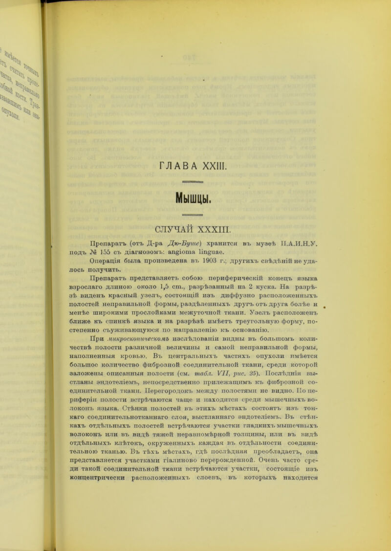 Мышцы. СЛУЧАЙ XXXIII. Препаратъ (отъ Д-ра Дю-Буше) хранится въ музеѣ П.А.И.Н.У. подъ № 155 съ діагнозомъ: ап§іота Ііпдиаѳ. Операція была произведена въ 1903 г.; другихъ свѣдѣній не уда- лось получить. Препаратъ представляетъ собою периферическій конецъ языка взрослаго длиною около 1,5 сш., разрѣзанный на 2 куска. На разрѣ- зѣ виденъ красный узелъ, состоящій изъ диффузно расположенныхъ полостей неправильной формы, раздѣленныхъ другъ отъ друга болѣе и менѣе широкими прослойками межуточной ткани. Узелъ расположена^ ближе къ спинкѣ языка и на разрѣзѣ имѣетъ треугольную форму, по- степенно съуживающуюся по направленію къ основанію. При микроскопическомъ изслѣдованіи видны въ большомъ коли- чествѣ полости различной величины и самой неправильной формы, наполненныя кровью. Въ центральныхъ частяхъ опухоли имѣется большое количество фиброзной соединительной ткани, среди которой заложены описанныя полости (см. табл. VII, рис. 25). Послѣднія вы- стланы эндотеліемъ, непосредственно прилежащимъ къ фиброзной со- единительной ткани. Перегородокъ между полостями не видно. По пе- риферіи полости встрѣчаются чаще и находятся среди мышечныхъ во- локонъ языка. Стѣнки полостей въ этихъ мѣстахъ состоятъ изъ тон- каго соединительнотканнаго слоя, выстланнаго эндотеліемъ. Въ стѣн- кахъ отдѣльныхъ полостей встрѣчаются участки гладкихъ мышечныхъ волоконъ или въ видѣ тяжей неравномѣрной толщины, или въ видѣ отдѣльныхъ клѣтокъ, окруженныхъ каждая въ отдѣльности соедини- тельною тканью. Въ тѣхъ мѣстахъ, гдѣ послѣдняя преобладаетъ, она представляется участками гіалиново перерожденной. Очень часто сре- ди такой соединительной ткани встрѣчаются участки, состоящіе изъ концентрически расположенныхъ слоевъ, въ которыхъ находятся