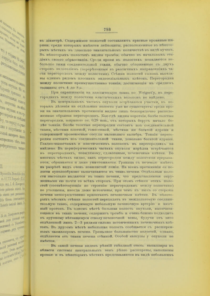 въ діаметрѣ. Содержимое полостей составляютъ красные кровяные ша- рики. среди которыхъ имѣются лейкоциты, расположенные въ нѣкото- рыхъ мѣстахъ въ довольно значительномъ количествѣ въ видѣ кучекъ. Въ нѣкоторыхъ полостях'ъ видны тромбы, обычно въ начальныхъ ста- діяхъ своего образованія. Среди крови въ полостяхъ попадаются не- большіе тяжи соединительной ткани, обычно обложенные съ двухъ сторонъ эндотеліемъ (перерѣзанныя въ различныхъ направленіяхъ ча- сти перегородокъ между полостями). Стѣнки полостей сплошь выстла- ны однимъ рядомъ плоскихъ эндотеліальныхъ клѣтокъ. Перегородки между полостями преимущественно тонкія, достигающія въ среднем!, толщины отъ 4 до 8 м- При окрашиваніи на эластическую ткань по \Ѵеі§ѳгГу, въ пере- городкахъ между полостями эластическихъ волоконъ не найдено. Въ центральныхъ частяхъ опухоли встрѣчаются участки, въ ко- торыхъ дѣленія на отдѣльныя полости уже не существуетъ: среди кро- ви на значительномъ протяженіи видны лишь безпорядочно располо- женные обрывки перегородокъ. Кое-гдѣ видны короткія, болѣе толстыя перегородки, шириною ок. 0,28 гит., отъ которыхъ берутъ начало бо- лѣе тонкія. Болѣе толстыя перегородки состоятъ изъ соединительной ткани, мѣстами плотной, гомогенной, мѣстами же богатой ядрами и содержащей кровеносные сосуды маленькаго калибра. Тонкія перего- родки состоятъ изъ соединительной ткани, довольно богатой ядрами. Гладко-мышечныхъ и эластическихъ волоконъ въ перегородкахъ не найдено. Въ периферическихъ частяхъ опухоли изрѣдка встрѣчаются въ перегородкахъ, иовидимому, сдавленныя, печеночныя клѣтки. Во многихъ мѣстахъ видно, какъ перегородки между полостями прерыва- ются, обрываются и даже уничтожаются. Граница съ печенью имѣетъ на разрѣзѣ видъ очень извилистой линіи. На всемъ протяженіи ея по- лости куполообразно выпячиваются въ ткань печени. Отдѣльныя поло- сти настолько выдаются въ ткань печени, что представляются окру- женными ею почти со всѣхъ сторонъ. При этомъ стѣнки этихъ поло- стей (соотвѣтствующія по строенію перегородкамъ между полостями) не утолщены, иногда даже истончены, при чемъ къ нимъ со стороны печени непосредственно прилегаютъ печеночныя клѣтки. Въ нѣкото- рыхъ мѣстахъ стѣнки полостей переходятъ въ междольковую соедини- тельную ткань, содержащую небольшую печеночную артерію и желч- ный протокъ. Въ одномъ мѣстѣ большая полость опухоли, выпячива- ющаяся въ ткань печени, содержитъ тромбъ и очень близко подходитъ къ крупному вѣтвящемуся стволу печеночной вены, будучи отъ него отдѣленной лишь 2—3 рядами сильно истонченныхъ печеночныхъ клѣ- токъ. Въ другомъ мѣстѣ небольшая полость сообщается съ расширен- нымъ капилляромъ печени. Громадное большинство полостей, однако, отдѣляется отъ ткани печени стѣнкой. Особой капсулы у опухоли не имѣется. Въ самой печени виденъ рѣзкій гнѣздный стазъ: капилляры въ области системы центральныхъ венъ рѣзко расширены, наполнены кровью и въ нѣкоторыхъ мѣстахъ представляются въ видѣ небольшихъ