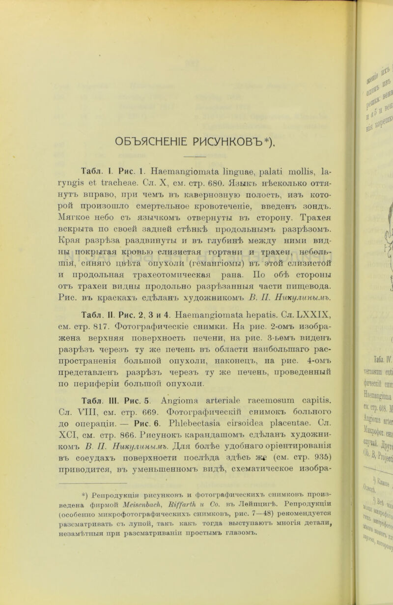 ОБЪЯСНЕНІЕ РИСУНКОВЪ*). Табл. I. Рис. 1. Наетап&іотаіа 1іп§іте, раіаіл тоіііз, 1а- гупоіз еі ігасЬеае. Сл. X, см. стр. 680. Языкъ нѣсколько оття- нутъ вправо, при чемъ въ кавернозную полость, изъ кото- рой произошло смертельное кровотеченіе, введенъ зондъ. Мягкое небо съ язычкомъ отвернуты въ сторону. Трахея вскрыта по своей задней стѣнкѣ продольнымъ разрѣзомъ. Края разрѣза раздвинуты и въ глубинѣ между ними вид- ны покрытая кровью слизистая гортани и трахеи, неболь- шія/синяго цвѣта опухоли (гемангіомы) въ этой слизистой и продольная трахеотомическая рана. По обѣ стороны отъ трахеи видны продольно разрѣзанныя части пищевода. Рис. въ краскахъ сдѣланъ художникомъ В. 77. Никулинымъ. Табл. II. Рис. 2, 3 и 4. НаетанДотаІа Ьераііз. Сл. ЬХХІХ, см. стр. 817. Фотографическіе снимки. На рис. 2-омъ изобра- жена верхняя поверхность печени, на рис. 3-ьѳмъ виденъ разрѣзъ черезъ ту же печень въ области наибольшаго рас- пространенія большой опухоли, наконецъ, на рис. 4-омъ представленъ разрѣзъ черезъ ту же печень, проведенный по периферіи большой опухоли. Табл. III. Рис. 5 Ап^іота агіегіаіе гаеетойшн сарііів. Сл. VIII, см. стр. 669. Фотографическій снимокъ больного до операціи. — Рис. 6. РЫеЪесіазіа сігзоісіеа ріасѳпіае. Сл. ХСІ, см. стр. 866. Рисунокъ карандашомъ сдѣланъ художни- комъ В. II. Никулинымъ. Для болѣе удобнаго оріентированія въ сосудахъ поверхности послѣда здѣсь ж^ (см. стр. 935) приводится, въ уменьшенномъ видѣ, схематическое изобра- *) Репродукція рисунковъ и фотографическихъ снимковъ произ- ведена фирмой МегвепЪасН, ШЦаНН и Со. въ Лейпцигѣ. Репродукціи (особенно микрофотографическихъ снимковъ, рис. 7—48) рекомендуется разсматривать съ лупой, такъ какъ тогда выступаютъ многія детали, незамѣтныя при разсматриваніи простымъ глазомъ.