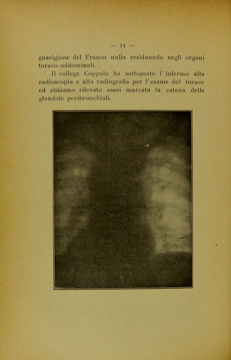 guarigione del Franco nulla residuando negli organi toraco-addoin inali. 11 collega Coppola ha sottoposto 1’ infermo alla radioscopia e alla radiogralia per Tesarne del torace ed abbiamo rilevato assai marcata la catena delle glandole peri bronchiali.