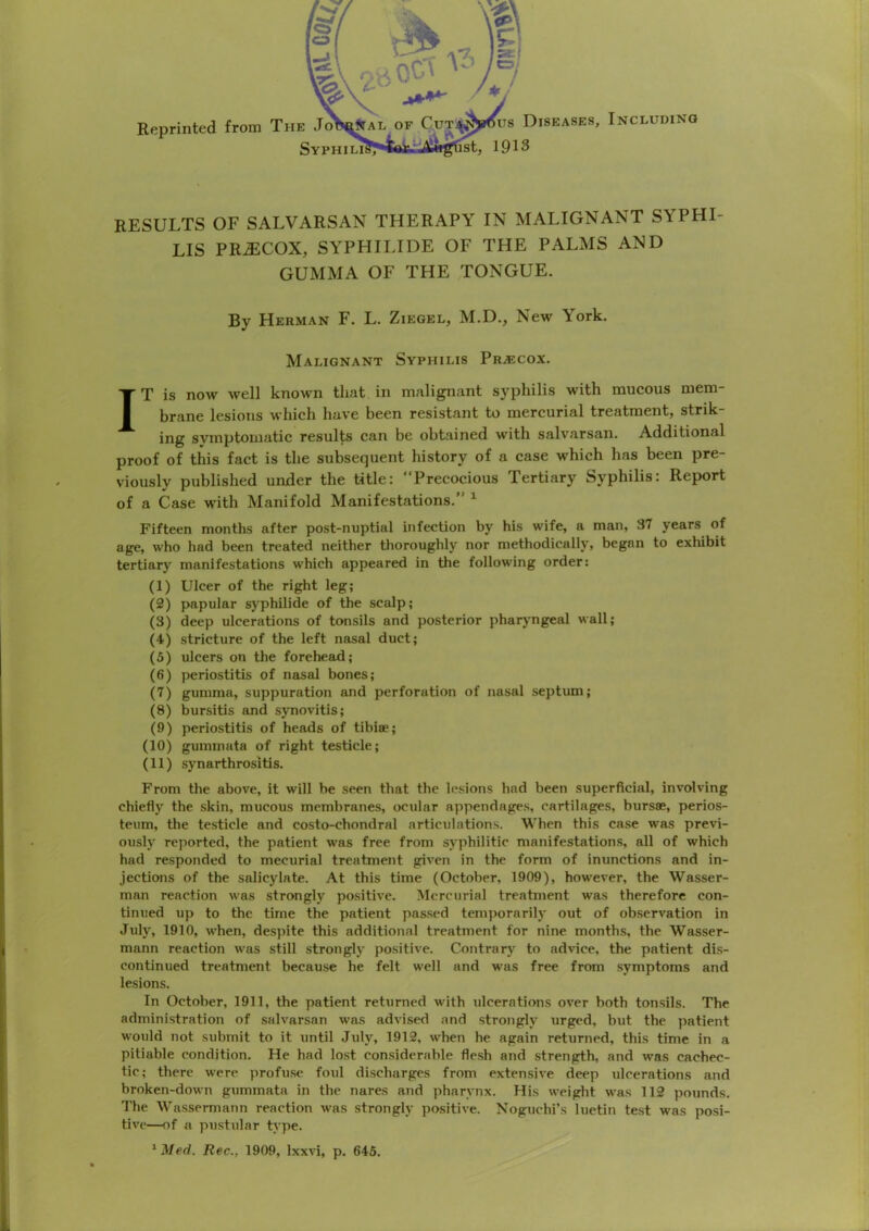 RESULTS OF SALVARSAN THERAPY IN MALIGNANT SYPHI- LIS PR^COX, SYPHILIDE OF THE PALMS AND GUMMA OF THE TONGUE. By Herman F. L. Ziegel, M.D., New York. Malignant Syphilis Pr^cox. IT is now well known that in malignant syphilis with mucous mem- brane lesions which have been resistant to mercurial treatment, strik- ing symptomatic resulte can be obtained with salvarsan. Additional proof of this fact is the subsequent history of a case which has been pre- viously published under the title: Precocious Tertiary Syphilis: Report of a Case with Manifold Manifestations.” ^ Fifteen months after post-nuptial infection by his wife, a man, 37 years of age, who had been treated neither thoroughly nor methodically, began to exhibit tertiary manifestations which appeared in the following order: (1) Ulcer of the right leg; (2) papular syphilide of the scalp; (3) deep ulcerations of tonsils and posterior pharjmgeal wall; (4) stricture of the left nasal duct; (5) ulcers on the forehead; (6) periostitis of nasal bones; (7) gumma, suppuration and perforation of nasal septum; (8) bursitis and synovitis; (9) periostitis of heads of tihiae; (10) gummata of right testicle; (11) synarthrositis. From the above, it will be seen that the lesions had been superficial, involving chiefly the skin, mucous membranes, ocular appendages, cartilages, bursae, perios- teum, the testicle and costo-chondral articulations. When this case was previ- ously reported, the patient was free from syphilitic manifestations, all of which had responded to mecurial treatment given in the form of inunctions and in- jections of the salicylate. At this time (October, 1909), however, the Wasser- man reaction was strongly positive. Mercurial treatment was therefore con- tinued up to the time the patient pas.sed temporarilj- out of observation in July, 1910, when, despite this additional treatment for nine months, the Wasser- mann reaction was still strongly positive. Contrary to advice, the patient dis- continued treatment because he felt well and was free from symptoms and lesions. In October, 1911, the patient returned with ulcerations over both tonsils. The administration of salvarsan was advised and strongly urged, but the patient would not submit to it until July, 1912, when he again returned, this time in a pitiable condition. He had lo.st considerable fle.sh and strength, and was cachec- tic; there were profuse foul discharges from extensive deep ulcerations and broken-down gummata in the nares and pharynx. His weight was 112 pounds. The Wassermann reaction was strongly positive. Noguchi’s luetin test was posi- tive—of a pustular type. ^iled. Rec., 1909, Ixxvi, p. 645.