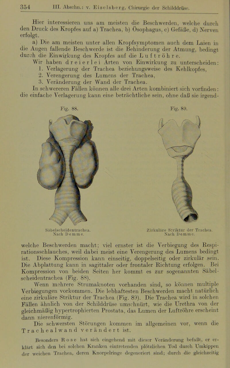 Hier interessieren uns am meisten die Beschwerden, welche durch den Druck des Kropfes auf a) Trachea, b) Ösophagus, c) Gefäße, d) Nerven erfolgt. a) Die am meisten unter allen Kropfsymptomen auch dem Laien in die Augen fallende Beschwerde ist die Behinderung der Atmung, bedingt durch die Einwirkung des Kropfes auf die L u f t r ö h r e. Wir haben dreierlei Arten von Einwirkung zu unterscheiden: 1. Verlagerung der Trachea beziehungsweise des Kehlkopfes, 2. Verengerung des Lumens der Trachea, 3. Veränderung der Wand der Trachea. In schwereren Fällen können alle drei Arten kombiniert sich vorfinden: die einfache Verlagerung kann eine beträchtliche sein, ohne daß sie irgencl- Fig. 88. Fig. 89. Säbelselieidentraehea. Nach Derame. Zirkuläre Sfviktur der Trachea. Nach Deminc. welche Beschwerden macht; viel ernster ist die Verbiegung des Respi- rationsschlauches, weil dabei meist eine Verengerung des Lumens bedingt ist. Diese Kompression kann einseitig, doppelseitig oder zirkulär sein. Die Abplattung kann in sagittaler oder frontaler Richtung erfolgen. Bei Kompression von beiden Seiten her kommt es zur sogenannten Säbel- scheidentrachea (Fig. 88). Wenn mehrere Strumaknoten vorhanden sind, so können multiple Verbiegungen Vorkommen. Die lebhaftesten Beschwerden macht natürlich eine zirkuläre Striktur der Trachea (Fig. 81)). Die Trachea wird in solchen Fällen ähnlich von der Schilddrüse umschnürt, wie die Urethra von der gleichmäßig hypertrophierten Prostata, das Lumen der Luftröhre erscheint dann nierenförmig. Die schwersten Störungen kommen im allgemeinen vor, wenn die Tracheal wand verändert ist. Besonders Rose hat sich eingehend mit dieser Veränderung befaßt, er er- klärt sich den bei solchen Kranken eintretenden plötzlichen Tod durch Umkippen der weichen Trachea, deren Knorpelringe degeneriert sind; durch die gleichzeitig