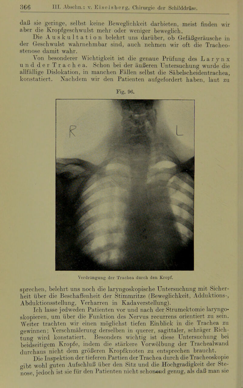 daß sie geringe, selbst keine Beweglichkeit darbieten, meist finden wir aber die Kropfgeschwulst mehr oder weniger beweglich. Die Auskultation belehrt uns darüber, ob Gefäßgeräusche in der Geschwulst wahrnehmbar sind, auch nehmen wir oft die Tracheo- stenose damit wahr. Von besonderer Wichtigkeit ist die genaue Prüfung des Larynx u 11 d de r Trachea. Schon bei der äußeren Untersuchung wurde die allfällige Dislokation, in manchen Fällen selbst die Säbelscheidentrachea, konstatiert. Nachdem wir den Patienten aufgefordert haben, laut zu Verdrängung der Trachea durch den Kropf. sprechen, belehrt uns noch die laryngoskopische Untersuchung mit Sicher- heit über die Beschaffenheit der Stimmritze (Beweglichkeit, Adduktions-, Abduktionsstellung, Verharren in Kadaverstellung). Ich lasse jedweden Patienten vor und nach der Strumektomie laryngo- skopieren, um über die Funktion des Nervus recurrens orientiert zu sein. Weiter trachten wir einen möglichst tiefen Einblick in die Trachea zu gewinnen; Verschmälerung derselben in querer, sagittaler, schräger Rich- tung wird konstatiert. Besonders wichtig ist diese Untersuchung bei beidseitigem Kropfe, indem die stärkere Vorwölbung der Trachealwand durchaus nicht dem größeren Kropfknoten zu entsprechen braucht. Die Inspektion der tieferen Partien der Trachea durch die Tracheoskopie gibt wohl guten Aufschluß über den Sitz und die Hochgradigkeit der Ste- nose, jedoch ist sie für den Patienten nicht schonend genug, als daß man sie