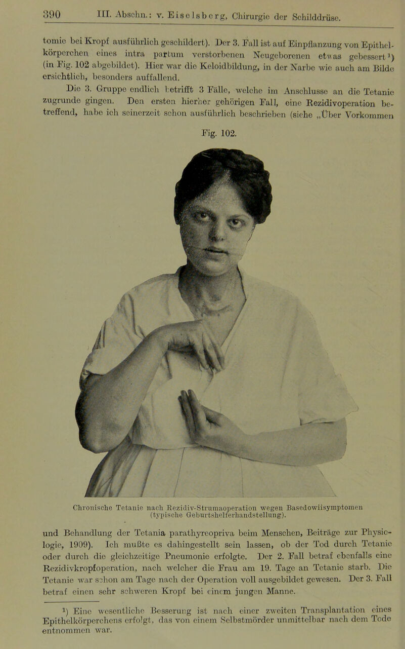 tomie bei Kropf ausführlich geschildert). Der 3. Fall ist auf Einpflanzung von Epithel- körperchen eines intra partum verstorbenen Neugeborenen etwas gebessert1) (in Fig. 102 abgebildet). Hier war die Keloidbildung, in der Narbe wie auch am Bilde ersichtlich, besonders auffallend. Die 3. Gruppe endlich betrifft 3 Fälle, welche im Anschlüsse an die Tetanie zugrunde gingen. Den ersten hierher gehörigen Fall, eine Rezidivoperation be- treffend, habe ich seinerzeit schon ausführlich beschrieben (siche „Über Vorkommen Fig. 102. Chronische Tetanie nach Rezidiv-Strumaoperation wegen Basedowiisymptomen (typische Geburtshelferhandstellung). und Behandlung der Tetania parathyreopriva beim Menschen, Beiträge zur Physio- logie, 1909). Ich mußte es dahingestellt sein lassen, ob der Tod durch Tetanie oder durch die gleichzeitige Pneumonie erfolgte. Der 2. Fall betraf ebenfalls eine Rezidivkropfoperation, nach welcher die Frau am 19. Tage an Tetanie starb. Die Tetanie war schon am Tage nach der Operation voll ausgebildet gewesen. Der 3. Fall betraf einen sehr schweren Kropf bei einem jungen Manne. *) Eine wesentliche Besserung ist nach einer zweiten Transplantation eines Epithelkörperchens erfolgt, das von einem Selbstmörder unmittelbar nach dem Tode entnommen war.