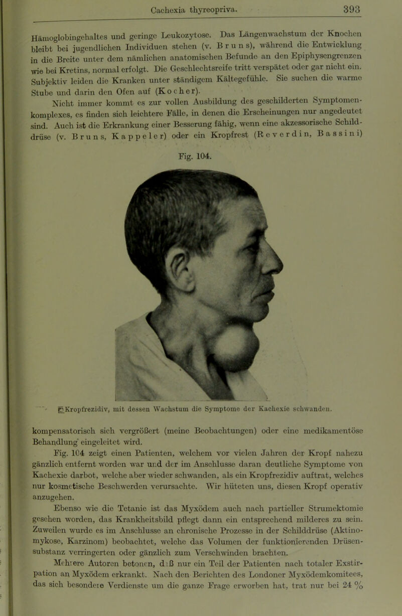 Hämoglobingehaltes und geringe Leukozytose. Das Längenwachstum der Knochen bleibt bei jugendlichen Individuen stehen (v. Brun s), während die Entwicklung in die Breite unter dem nämlichen anatomischen Befunde an den Epiphysengrenzen wie bei Kretins, normal erfolgt. Die Geschlechtsreife tritt verspätet oder gar nicht ein. Subjektiv leiden die Kranken unter ständigem Kältegefühle. Sie suchen die warme Stube und darin den Ofen auf (Kocher). Nicht immer kommt es zur vollen Ausbildung des geschilderten S\ mptomen- komplexes, es finden sich leichtere Fälle, in denen die Erscheinungen nur angedeutet sind. Auch ist die Erkrankung einer Besserung fähig, wenn eine akzessorische Schild- drüse (v. Bruns, Kappeier) oder ein Kropfrest (Reverdin, Bassin i) Fig. 104. ßKropfrezidiv, mit dessen Wachstum die Symptome der Kachexie schwanden. kompensatorisch sich vergrößert (meine Beobachtungen) oder eine medikamentöse Behandlung eingeleitet wird. Fig. 104 zeigt einen Patienten, welchem vor vielen Jahren der Kropf nahezu gänzlich entfernt worden war und der im Anschlüsse daran deutliche Symptome von Kachexie darbot, welche aber wieder schwanden, als ein Kropfrezidiv auftrat, welches nur kosmetische Beschwerden verursachte. Wir hüteten uns, diesen Kropf operativ anzugehen. Ebenso wie die Tetanie ist das Myxödem auch nach partieller Strumektomie gesehen worden, das Krankheitsbild pflegt dann ein entsprechend milderes zu sein. Zuweilen wurde es im Anschlüsse an chronische Prozesse in der Schilddrüse (Aktino- mykose, Karzinom) beobachtet, welche das Volumen der funktionierenden Drüsen- substanz verringerten oder gänzlich zum Verschwinden brachten. Mehrere Autoren betonen, d iß nur ein Teil der Patienten nach totaler Exstir- pation an Myxödem erkrankt. Nach den Berichten des Londoner Myxödemkomitees, das sich besondere Verdienste um die ganze Frage erworben hat, trat nur bei 24 %
