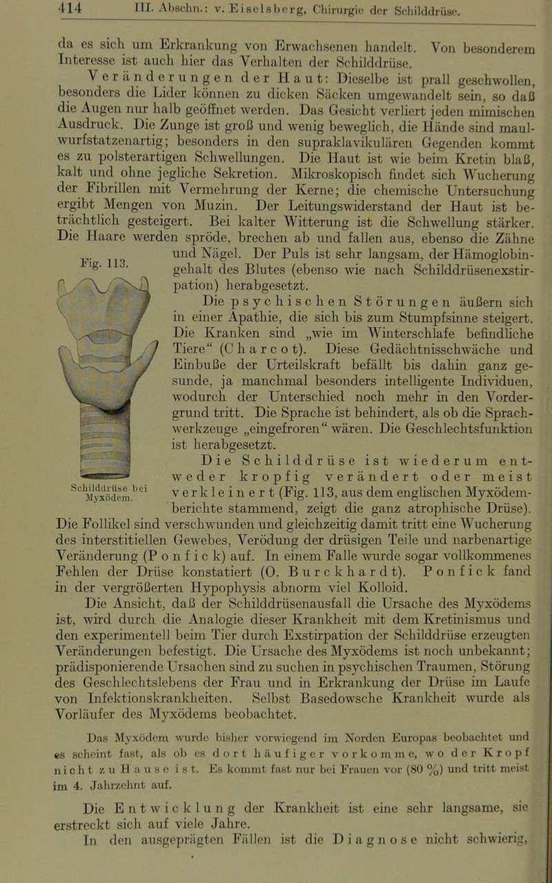 da es sich um Erkrankung von Erwachsenen handelt. Von besonderem Interesse ist auch hier das Verhalten der Schilddrüse. V e r ä n d e rungen der Haut: Dieselbe ist prall geschwollen, besonders die Lider können zu dicken Säcken umgewandelt sein, so daß die Augen nur halb geöffnet werden. Das Gesicht verliert jeden mimischen Ausdruck. Die Zunge ist groß und wenig beweglich, die Hände sind maul- wurfstatzenartig; besonders in den supraklavikulären Gegenden kommt es zu polsterartigen Schwellungen. Die Haut ist wie beim Kretin blaß, kalt und ohne jegliche Sekretion. Mikroskopisch findet sich Wucherung der Fibrillen mit Vermehrung der Kerne; die chemische Untersuchung ergibt Mengen von Muzin. Der Leitungswiderstand der Haut ist be- trächtlich gesteigert. Bei kalter Witterung ist die Schwellung stärker. Die Haare werden spröde, brechen ab und fallen aus, ebenso die Zähne und Nägel. Der Puls ist sehr langsam, der Hämoglobin- gehalt des Blutes (ebenso wie nach Schilddrüsenexstir- pation) herabgesetzt. Die psychischen Störungen äußern sich in einer Apathie, die sich bis zum Stumpfsinne steigert. Die Kranken sind „wie im Winterschlafe befindliche Tiere“ (C h a r c o t). Diese Gedächtnisschwäche und Einbuße der Urteilskraft befällt bis dahin ganz ge- sunde, ja manchmal besonders intelligente Individuen, wodurch der Unterschied noch mehr in den Vorder- grund tritt. Die Sprache ist behindert, als ob die Sprach- werkzeuge „eingefroren“ wären. Die Geschlechtsfunktion ist herabgesetzt. Die Schilddrüse ist wiederum ent- weder kropfig verändert oder meist verkleinert (Fig. 113, aus dem englischen Myxödem- berichte stammend, zeigt die ganz atrophische Drüse). Die Follikel sind verschwunden und gleichzeitig damit tritt eine Wucherung des interstitiellen Gewebes, Verödung der drüsigen Teile und narbenartige Veränderung (P o n f i c k) auf. In einem Falle wurde sogar vollkommenes Fehlen der Drüse konstatiert (0. Burckhardt). P o n f i c k fand in der vergrößerten Hypophysis abnorm viel Kolloid. Die Ansicht, daß der Schilddrüsenausfall die Ursache des Myxödems ist, wird durch die Analogie dieser Krankheit mit dem Kretinismus und den experimentell beim Tier durch Exstirpation der Schilddrüse erzeugten Veränderungen befestigt. Die Ursache des Myxödems ist noch unbekannt; prädisponierende Ursachen sind zu suchen in psychischen Traumen, Störung des Geschlechtslebens der Frau und in Erkrankung der Drüse im Laufe von Infektionskrankheiten. Selbst Basedowsche Krankheit wurde als Vorläufer des Myxödems beobachtet. Das Myxödem wurde bisher vorwiegend im Norden Europas beobachtet und es scheint fast, als ob es dort häufiger vorko m me, w o der Kropf nicht zu Hause ist. Es kommt fast nur bei Frauen vor (80 %) und tritt meist im 4. Jahrzehnt auf. Die Entwicklung der Krankheit ist eine sehr langsame, sie erstreckt sich auf viele Jahre. In den ausgeprägten Fällen ist die Diagnose nicht schwierig, Fig. 113. Schilddrüse bei Myxödem.