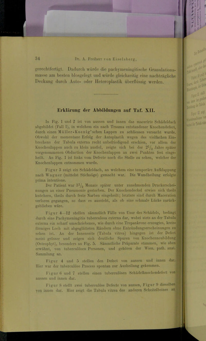 gerechtfertigt. Dadurch würde die pachymeningitische Granuiations- masse am besten blosgelegt und würde gleichzeitig eine nachträgliche Deckung durch Auto- oder Heteroplastik überflüssig werden. Erklärung der Abbildungen auf Taf. XII. In Fig. 1 und 2 ist von aussen und innen das macerirte Schädeldach abgebildet (Fall I), in welchem ein nach Trauma entstandener Knochendefect, durch einen Müller-Koenig’sehen Lappen zu schliessen versucht wurde. Obwohl der momentane Erfolg der Autoplastik wegen des vielfachen Ein- brechens der Tabula externa recht unbefriedigend erschien, vor allem der Knochenlappen auch zu klein ausfiel, zeigte sich bei der 21/, Jahre später vorgenommenen Obduction der Knochenlappen an zwei Punkten fest einge- heilt. An Fig. 1 ist links vom Defecte noch die Stelle zu sehen, welcher der Knochenlappen entnommen wurde. Figur 3 zeigt ein Schädeldach, an welchem eine temporäre Aufklappung nach Wagner (mittelst Stichsäge) gemacht war. Die Wundheilung erfolgte prima intentione. Der Patient war ?>lL Monate später unter zunehmenden Druckerschei- nungen an einer Pneumonie gestorben. Der Knochendeckel erwies sich theils knöchern, theils durch feste Narben eingeheilt; letztere sind durch Maceration verloren gegangen, so dass es aussieht, als ob eine schmale Lücke zurück- geblieben wäre. Figur 4—12 stellen sämmtlich Fälle von Usur des Schädels, bedingt durch eine Pachymeningitis tuberculosa externa dar, wobei stets an der Tabula externa ein scharf umschriebenes, wie durch eine Trepankronc erzeugtes, kreis- förmiges Loch mit abgeglätteten Rändern ohne Entzündungserscheinungen zu sehen ist. An der Innenseite (Tabula vitrea) hingegen ist der Defect meist grösser und zeigen sich deutliche Spuren von Knochenneubildung (Osteophyt), besonders an Fig. 5. Sämmtliche Präparate stammen, wie oben erwähnt, von tuberculösen Personen, und gehören der Wien. path. anal. Sammlung an. Figur 4 und 5 stellen den Defect von aussen und innen dar. 1 Hier war der tuberculöse Process spontan zur Ausheilung gekommen. Figur 6 und 7 stellen einen tuberculösen Schädelknochendefcct von aussen und innen dar. Figur 8 stellt zwei tuberculöse Defecte von aussen, Figur 9 dieselben yon innen dar. liier zeigt die Tabula vitrea des anderen Scheitelbeines an