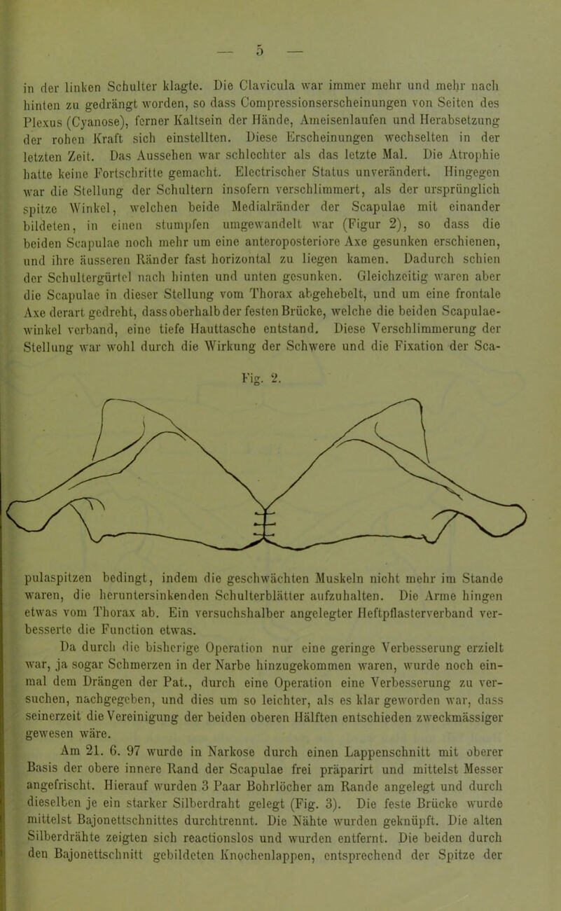 0 in der linken Schulter klagte. Die Clavicula war immer mehr und mehr nach hinten zu gedrängt worden, so dass Compressionserscheinungen von Seiten des Plexus (Cyanose), ferner Kaltsein der Hände, Ameisenlaufen und Herabsetzung der rohen Kraft sich einstcllten. Diese Erscheinungen wechselten in der letzten Zeit. Das Aussehen war schlechter als das letzte Mal. Die Atrophie hatte keine Fortschritte gemacht. Elcctrischer Status unverändert. Hingegen war die Stellung der Schultern insofern verschlimmert, als der ursprünglich spitze Winkel, welchen beide Medialränder der Scapulae mit einander bildeten, in einen stumpfen umgcwandelt war (Figur 2), so dass die beiden Scapulae noch mehr um eine anteroposteriore Axe gesunken erschienen, und ihre äusseren Ränder fast horizontal zu liegen kamen. Dadurch schien der Schultergürtel nach hinten und unten gesunken. Gleichzeitig waren aber die Scapulae in dieser Stellung vom Thorax abgehebelt, und um eine frontale Axe derart gedreht, dass oberhalb der festen Brücke, welche die beiden Scapulae- winkel verband, eine tiefe Hauttasche entstand. Diese Verschlimmerung der Stellung war wohl durch die Wirkung der Schwere und die Fixation der Sca- Fig. 2. pulaspitzen bedingt, indem die geschwächten Muskeln nicht mehr im Stande waren, die heruntersinkenden Schulterblätter aufzuhalten. Die Arme hingen etwas vom Thorax ab. Ein versuchshalber angelegter Heftpflasterverband ver- besserte die Function etwas. Da durch die bisherige Operation nur eine geringe Verbesserung erzielt war, ja sogar Schmerzen in der Narbe hinzugekommen waren, wurde noch ein- mal dem Drängen der Pat., durch eine Operation eine Verbesserung zu ver- suchen, nachgegeben, und dies um so leichter, als es klar geworden war, dass seinerzeit die Vereinigung der beiden oberen Hälften entschieden zweckmässiger gewesen wäre. Am 21. 6. 97 wurde in Narkose durch einen Lappenschnitt mit oberer Basis der obere innere Rand der Scapulae frei präparirt und mittelst Messer angefrischt. Hierauf wurden 3 Paar Bohrlöcher am Rande angelegt und durch dieselben je ein starker Silberdraht gelegt (Fig. 3). Die feste Brücke wurde mittelst Bajonettschnittes durchtrennt. Die Nähte wurden geknüpft. Die alten Silberdrähte zeigten sich reactionslos und wurden entfernt. Die beiden durch den Bajonettschnitt gebildeten Knochenlappen, entsprechend der Spitze der