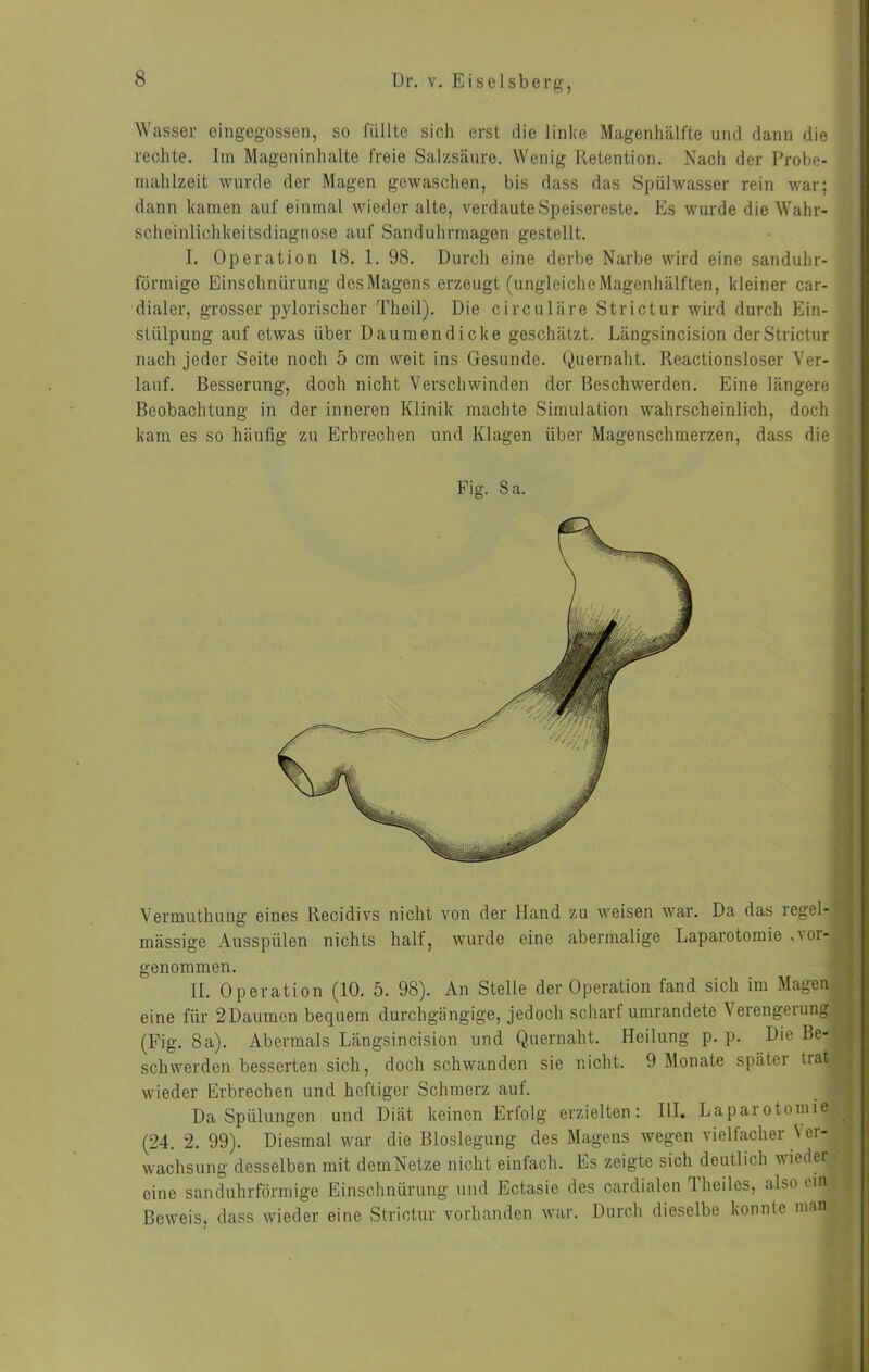 Wasser oingogosscn, so lullte sicli erst die linke Magenhälfte und dann die rechte. Im Mageninhalte freie Salzsäure. Wenig Retention. Nach der Probe- mahlzeit wurde der Magen gewaschen, bis dass das Spülwasser rein war; | dann kamen auf einmal wieder alte, verdaute Speisereste. Es wurde die Wahr- i scheinlichkeitsdiagnose auf Sanduhrmagen gestellt. i I. Operation IS. 1. 98. Durch eine derbe Narbe wird eine sanduhr- j förmige Einschnürung desMagens erzeugt (ungleichoMagenhälften, kleiner car- | dialer, grosser pylorischer Theil). Die circiiläre Strictur wird durch Ein- I slülpung auf etwas über Daumendicke geschätzt. Längsincision der Strictur f |j nach jeder Seite noch 5 cm weit ins Gesunde. Quernaht. Reactionsloser Ver- .! ■ lauf. Besserung, doch nicht Verschwinden der Beschwerden. Eine längere ?■; Beobachtung in der inneren Klinik machte Simulation wahrscheinlich, doch |i kam es so häufig zu Erbrechen und Klagen über Magenschmerzen, dass die | ' Vermuthung eines Recidivs nicht von der Hand zu weisen war. Da das regel- mässige Ausspülen nichts half, wurde eine abermalige Laparotomie .^oi- genoramen. II. Operation (10. 5. 98). An Stelle der Operation fand sich im Magen eine für 2Daumen bequem durchgängige, jedoch scharf umrandete Verengerung (Fig. 8a). Abermals Längsincision und Quernaht. Heilung p. p. Die Be- schwerden besserten sich, doch schwanden sie nicht. 9 Monate später trat wieder Erbrechen und heftiger Schmerz auf. Da Spülungen und Diät keinen Erfolg erzielten: HI. Laparotomie (24. 2. 99). Diesmal war die Bloslegung des Magens wegen vielfacher Ver- wachsung desselben mit demNetze nicht einfach. Es zeigte sich deutlich wieder eine sanduhrförmige Einschnürung und Ectasie des cardialen Theiles, also ein Beweis, dass wieder eine Strictur vorhanden war. Durch dieselbe konnte man Fig. 8 a,