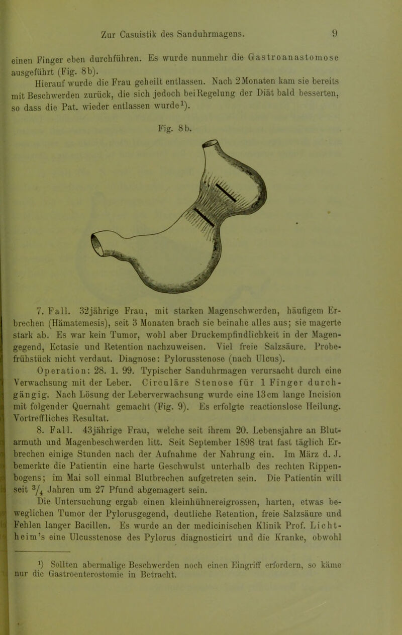 einen Finger eben durchführen. Es wurde nunmehr die Gastroanastomose ausgeführt (Fig. 8 b). Hierauf wurde die Frau geheilt entlassen. Nach 2Monaten kam sie bereits mit Beschwerden zurück, die sich jedoch beiKegelung der Diät bald besserten, so dass die Pat. wieder entlassen wurde ^). Fig. 8 b. 7. Fall. 32jährige Frau, mit starken Magenschwerden, häufigem Er- brechen (Hämatemesis), seit 3 Monaten brach sie beinahe alles aus; sie magerte stark ab. Es war kein Tumor, wohl aber Druckempfindlichkeit in der Magen- gegend, Ectasie und Retention nachzuweisen. Viel freie Salzsäure. Probe- ■' frühstück nicht verdaut. Diagnose: Pylorusstenose (nach Ulcus). |; Operation: 28. 1. 99. Typischer Sanduhrmagen verursacht durch eine S Verwachsung mit der Leber. Circuläre Stenose für 1 Finger durch- gängig. Nach Lösung der Leberverwachsung wurde eine 13cra lange Incision Imit folgender Quernaht gemacht (Fig. 9). Es erfolgte reactionslose Heilung. Vortreffliches Resultat. 8. Fall. 43jährige Frau, welche seit ihrem 20. Lebensjahre an Blut- armuth und Magenbeschwerden litt. Seit September 1898 trat fast täglich Er- brechen einige Stunden nach der Aufnahme der Nahrung ein. Im März d. .1. bemerkte die Patientin eine harte Geschwulst unterhalb des rechten Rippen- bogens; im Mai soll einmal Blutbrechen aufgetreten sein. Die Patientin will seit Jahren um 27 Pfund abgemagert sein. Die Untersuchung ergab einen kleinhühnereigrossen, harten, etwas be- weglichen Tumor der Pylorusgegend, deutliche Retention, freie Salzsäure und Fehlen langer Bacillen. Es wurde an der medicinischen Klinik Prof. Licht- heim’s eine Ulcusstenose des Pylorus diagnosticirt und die Kranke, obwohl *) Sollten abermalige Beschwerden noch einen Eingriff erfordern, so käme nur die Gastroenterostomie in Bcti'acht.